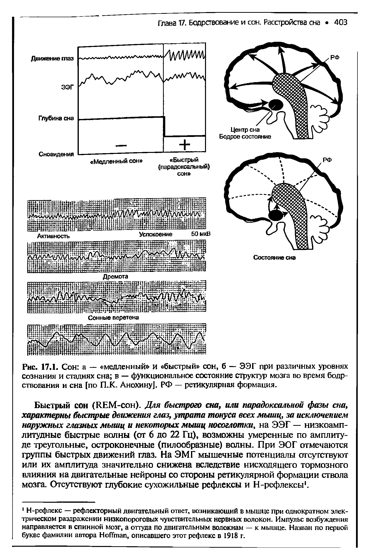 Рис. 17.1. Сон а — медленный и быстрый сон, б — ЭЭГ при различных уровнях сознания и стадиях сна в — функциональное состояние структур мозга во время бодрствования и сна [по П.К. Анохину]. РФ — ретикулярная формация.