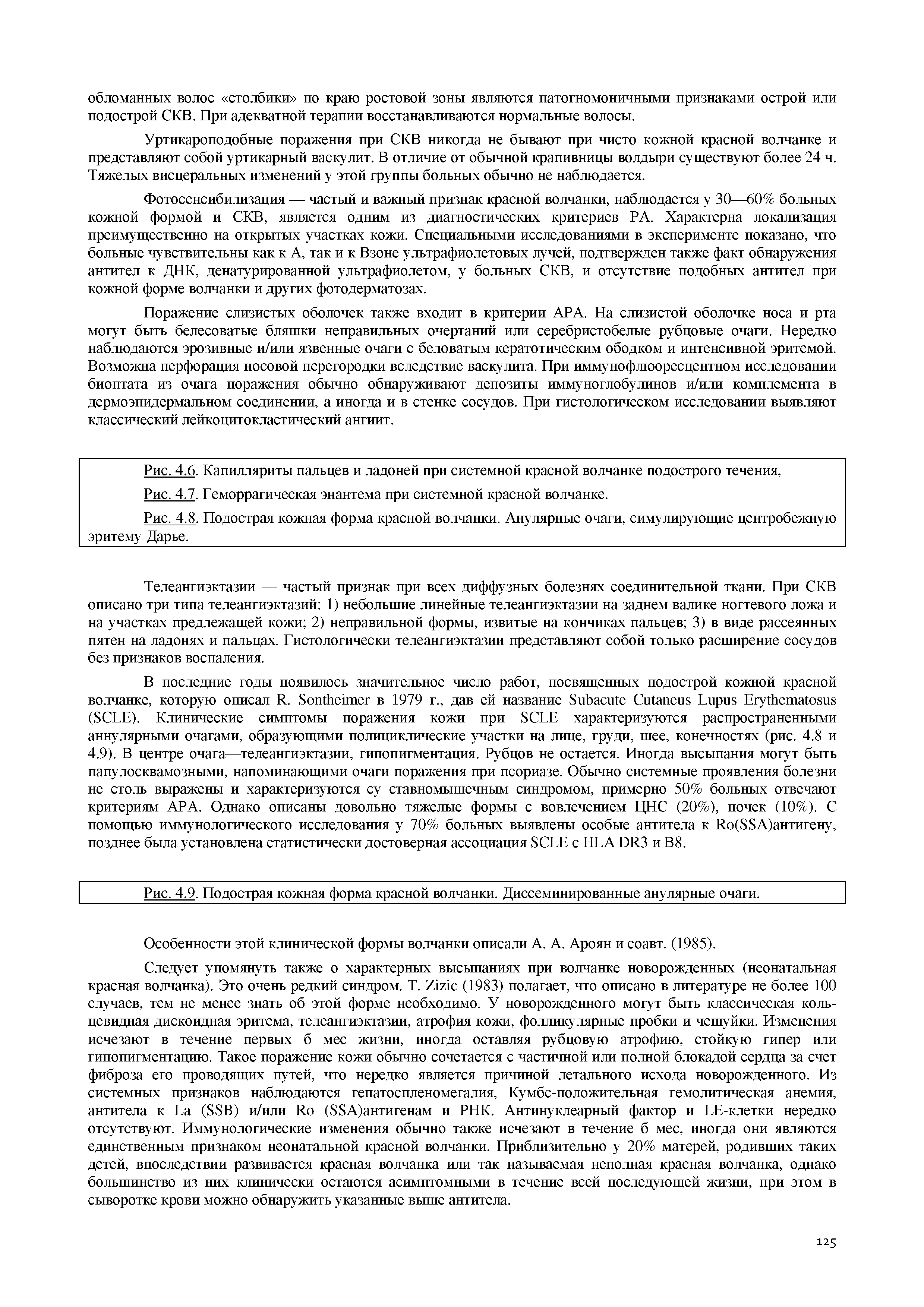 Рис. 4,9. Подострая кожная форма красной волчанки. Диссеминированные анулярные очаги.