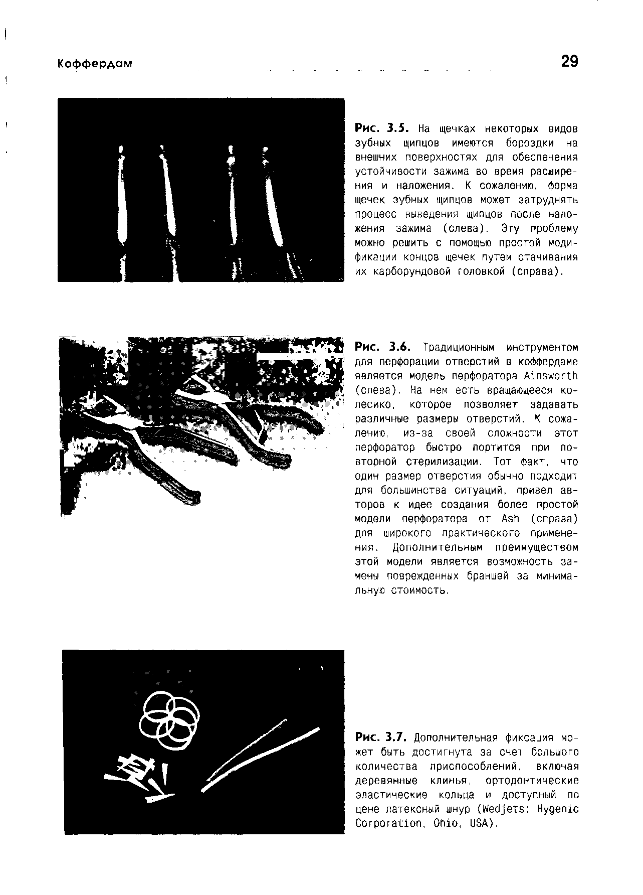 Рис. 3.7. Дополнительная фиксация может быть достигнута за счет большого количества приспособлений, включая деревянные клинья, ортодонтические эластические кольца и доступный по цене латексный шнур (W H C , O , USA).