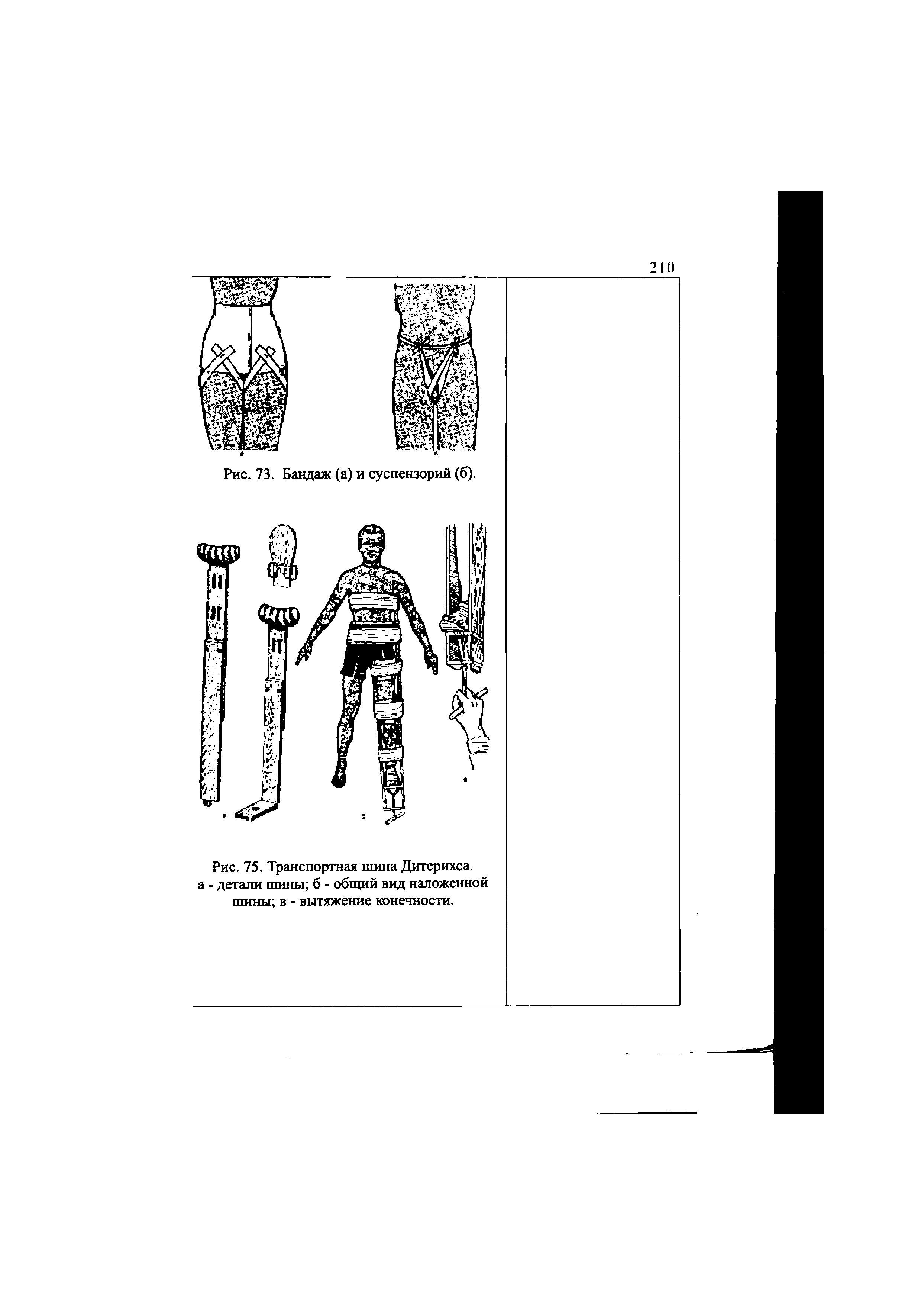 Рис. 75. Транспортная шина Дитерихса. а - детали шины б - общий вид наложенной шины в - вытяжение конечности.