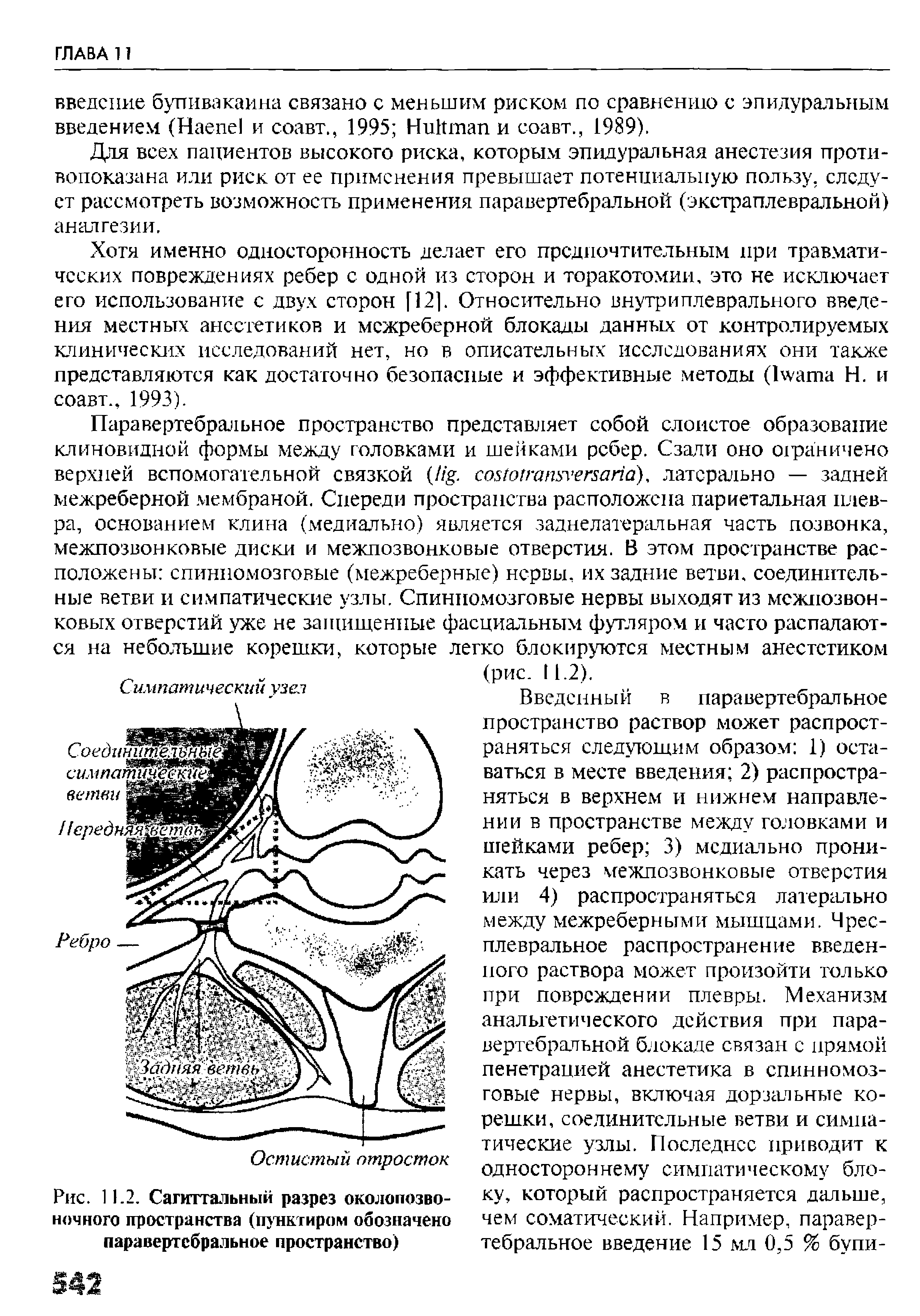 Рис. 11.2. Сагиттальный разрез околопозво-ночного пространства (пунктиром обозначено паравертебральное пространство)...