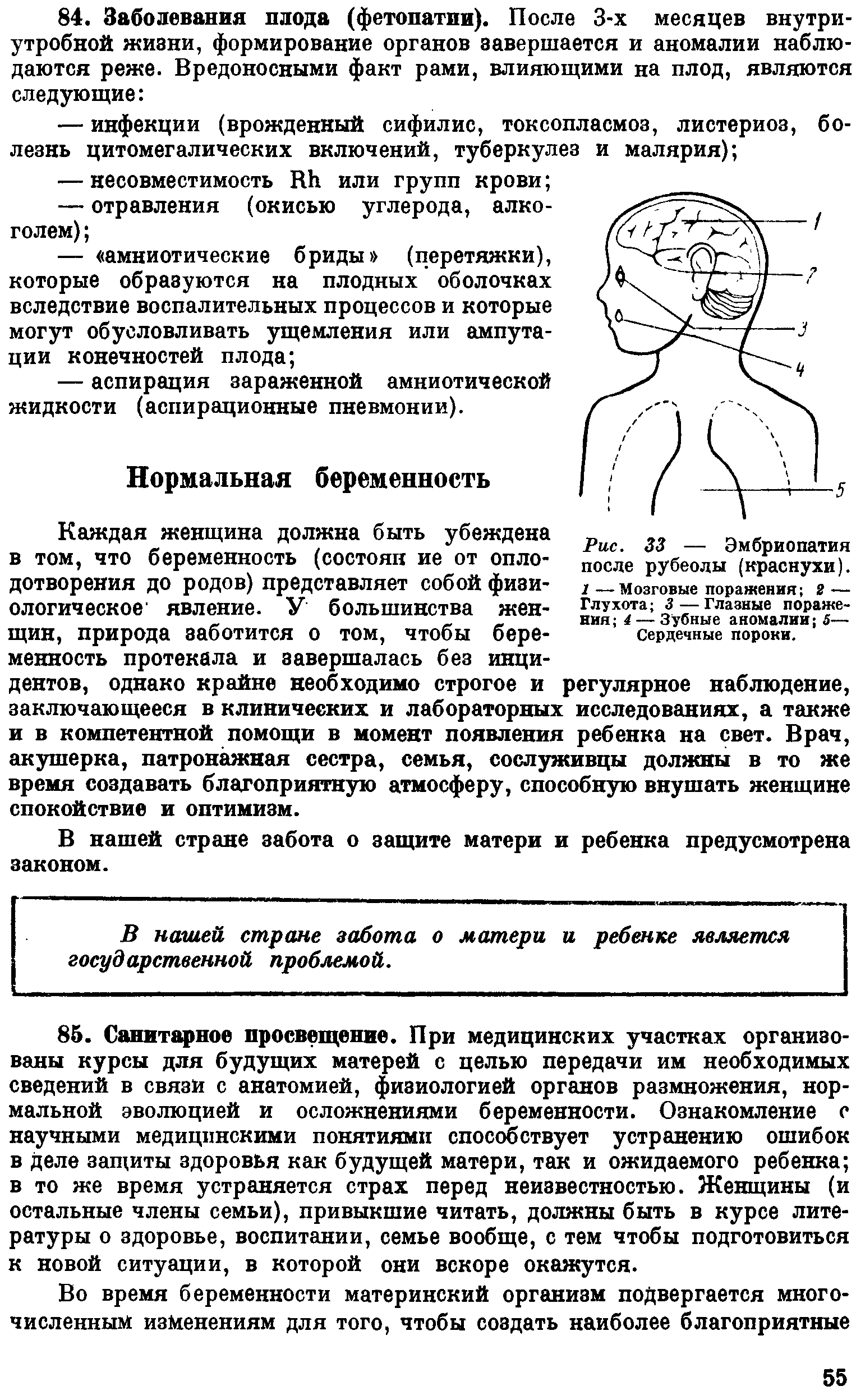 Рис. 33 — Эмбриопатия после рубеолы (краснухи). 1 —Мозговые поражения 2 — Глухота 3 — Глазные поражения 4— Зубные аномалии 3— Сердечные пороки.