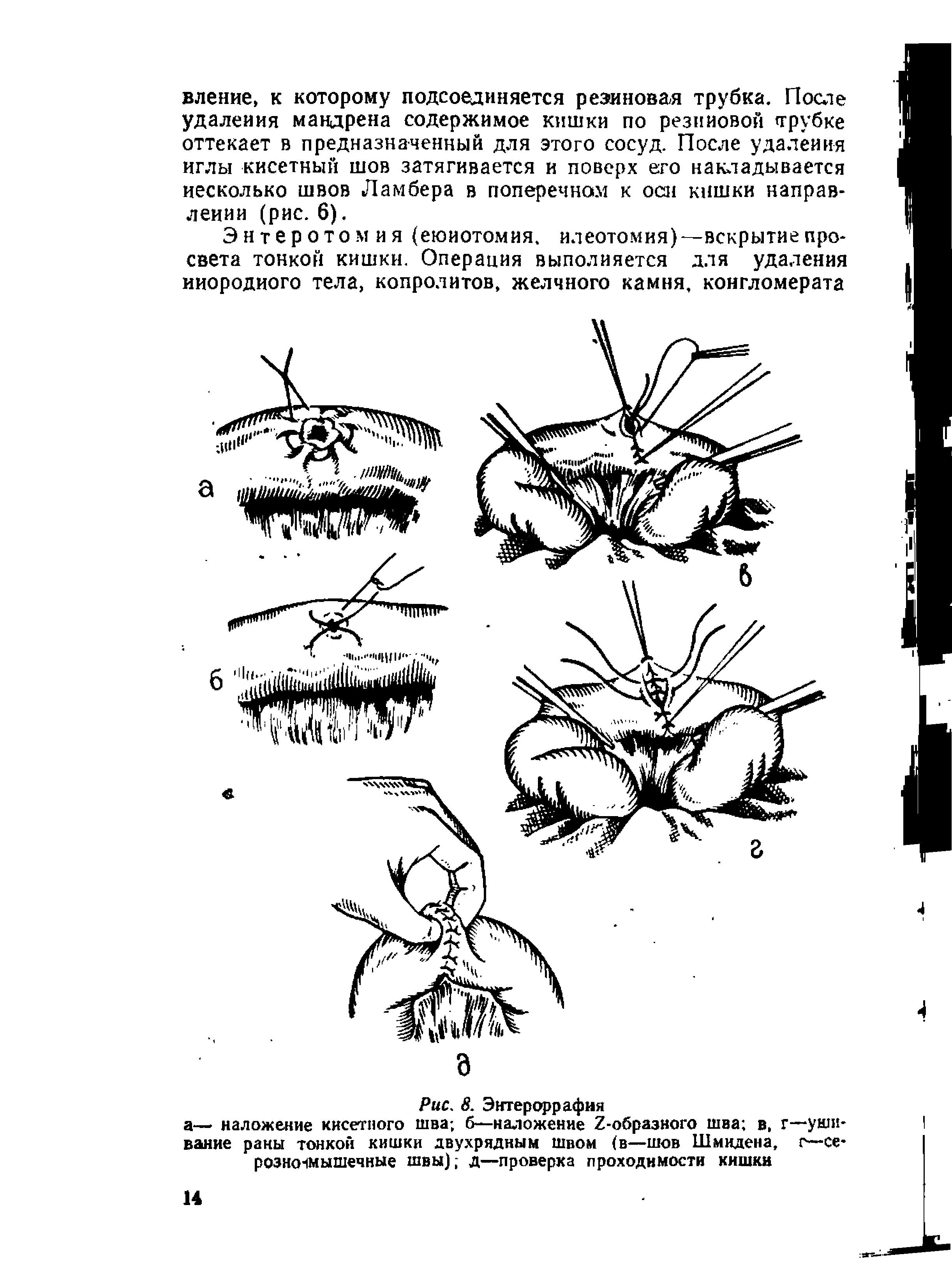 Рис. 8. Энтероррафия а— наложение кисетного шва б—наложение Х-образного шва в, г—ушивание раны тонкой кишки двухрядным швом в—шов Шмидена, г—серозно-мышечные швы) д—проверка проходимости кишки...