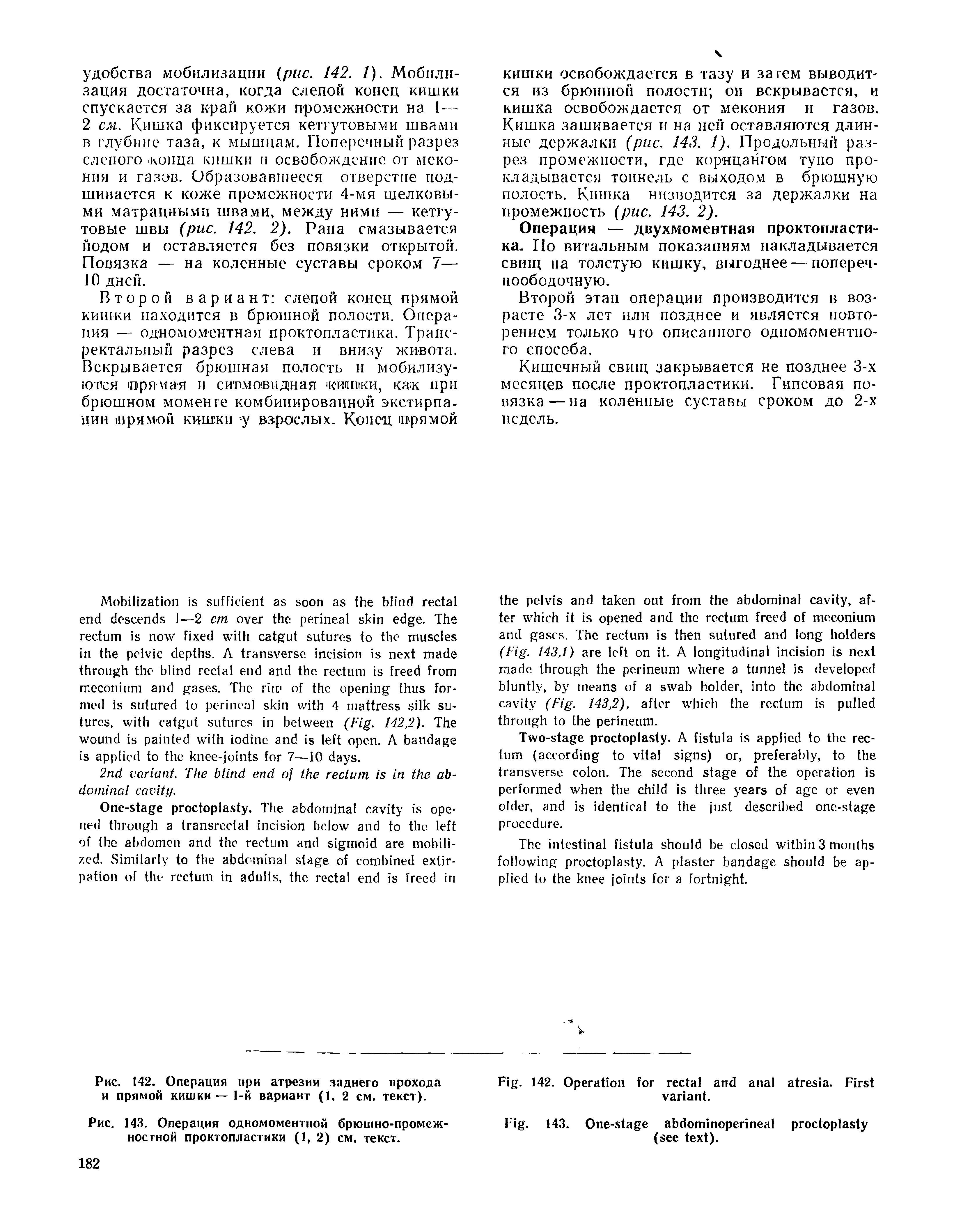 Рис. 142. Операция при атрезии заднего прохода и прямой кишки — 1-й вариант (1. 2 см. текст).