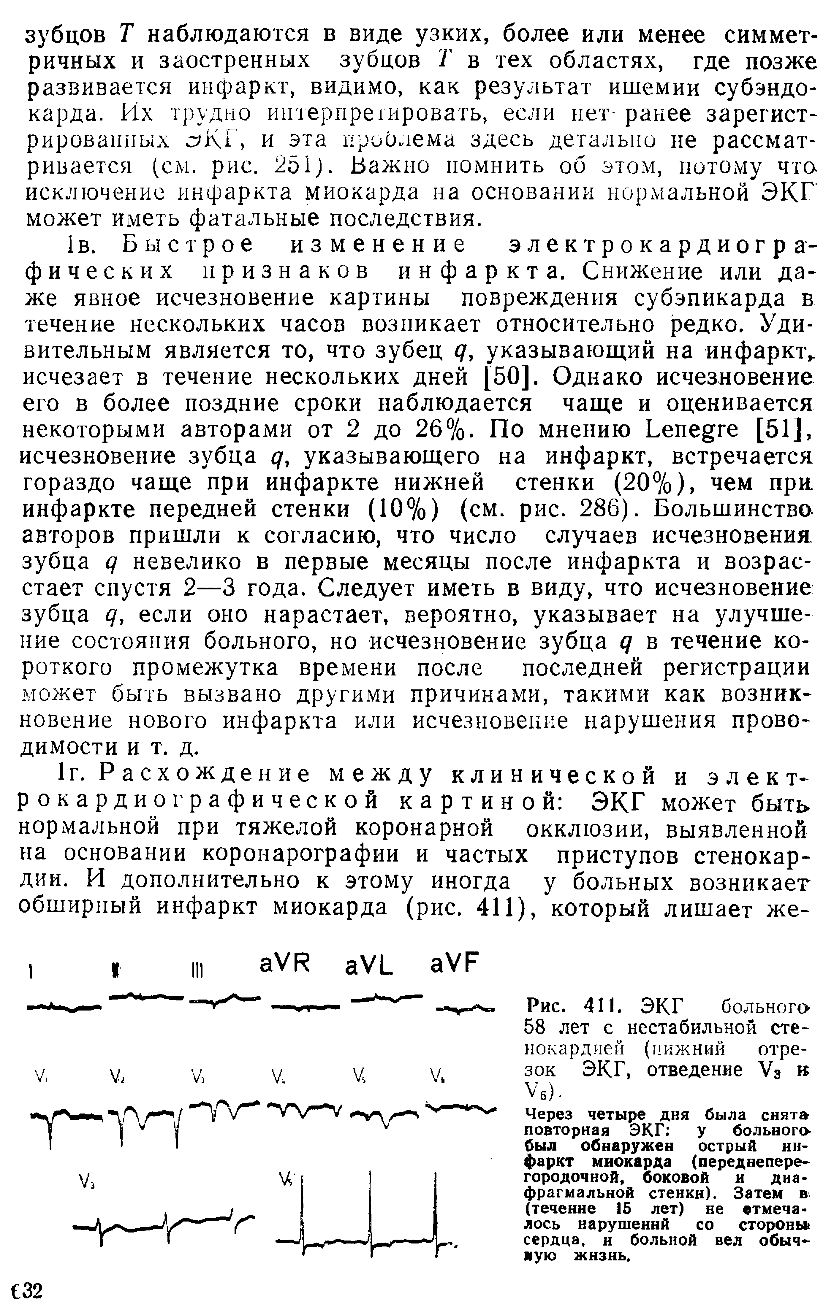 Рис. 411. ЭКГ больного 58 лет с нестабильной стенокардией (нижний отрезок ЭКГ, отведение Уз н Уб) >...