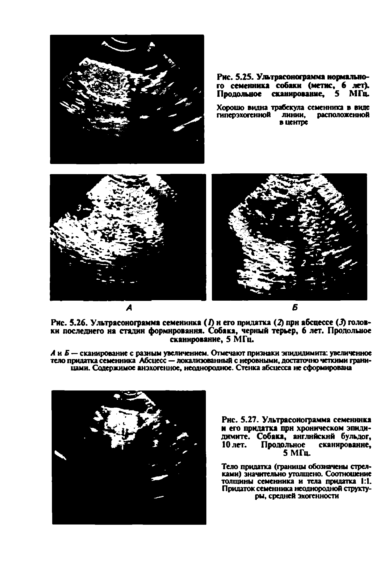 Рис. 5.26. Ультрасонограмма семенинка (/) н его придатка (2) при абсцессе головки последнего на стадии формирования. Собака, черный терьер, 6 лет. Продольное сканирование, 5 МГц.
