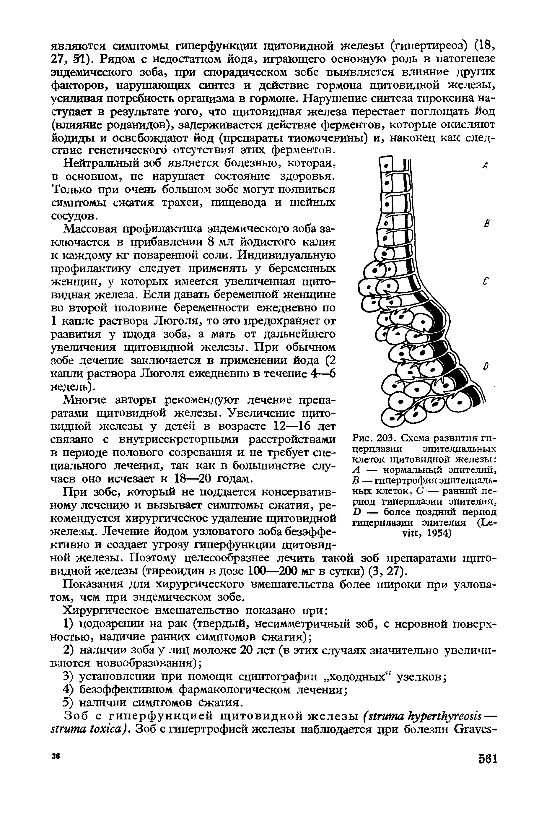 Рис. 203. Схема развития гиперплазии эпителиальных клеток щитовидной железы А — нормальный эпителий, В — гипертрофия эпителиальных клеток, С — ранний период гиперплазии эпителия, D — более поздний период гиперплазии эпителия (L , 1954)...