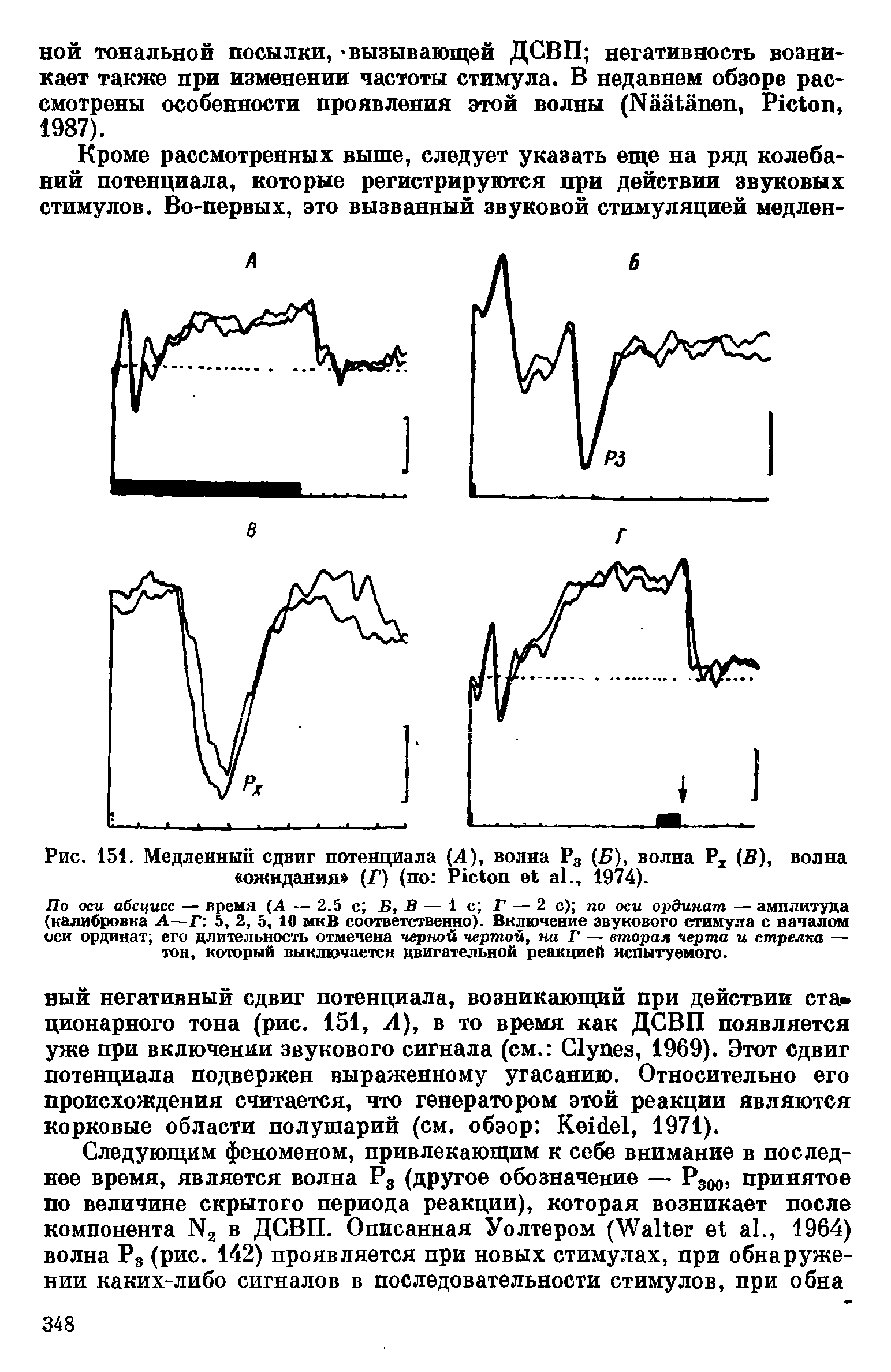 Рис. 151. Медленный сдвиг потенциала (4), волна Р3 (Б), волна Рх (В), волна ожидании (Г) (по P ., 1974).