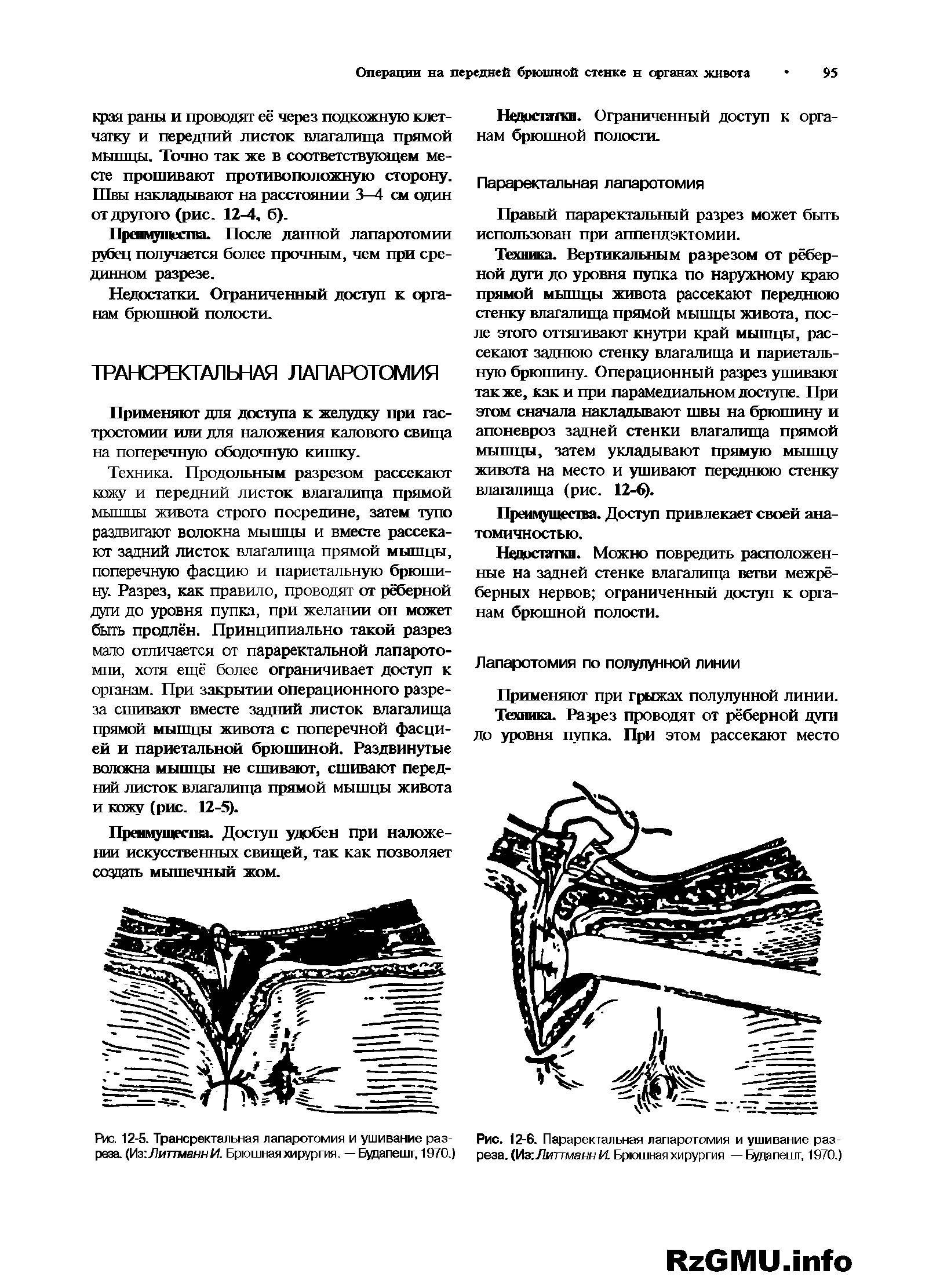 Рис. 12-5. Трансректальная лапаротомия и ушивание разреза. (У з ЛиттманнИ. Брюшнаяхирургия. — Будапешт, 1970.)...