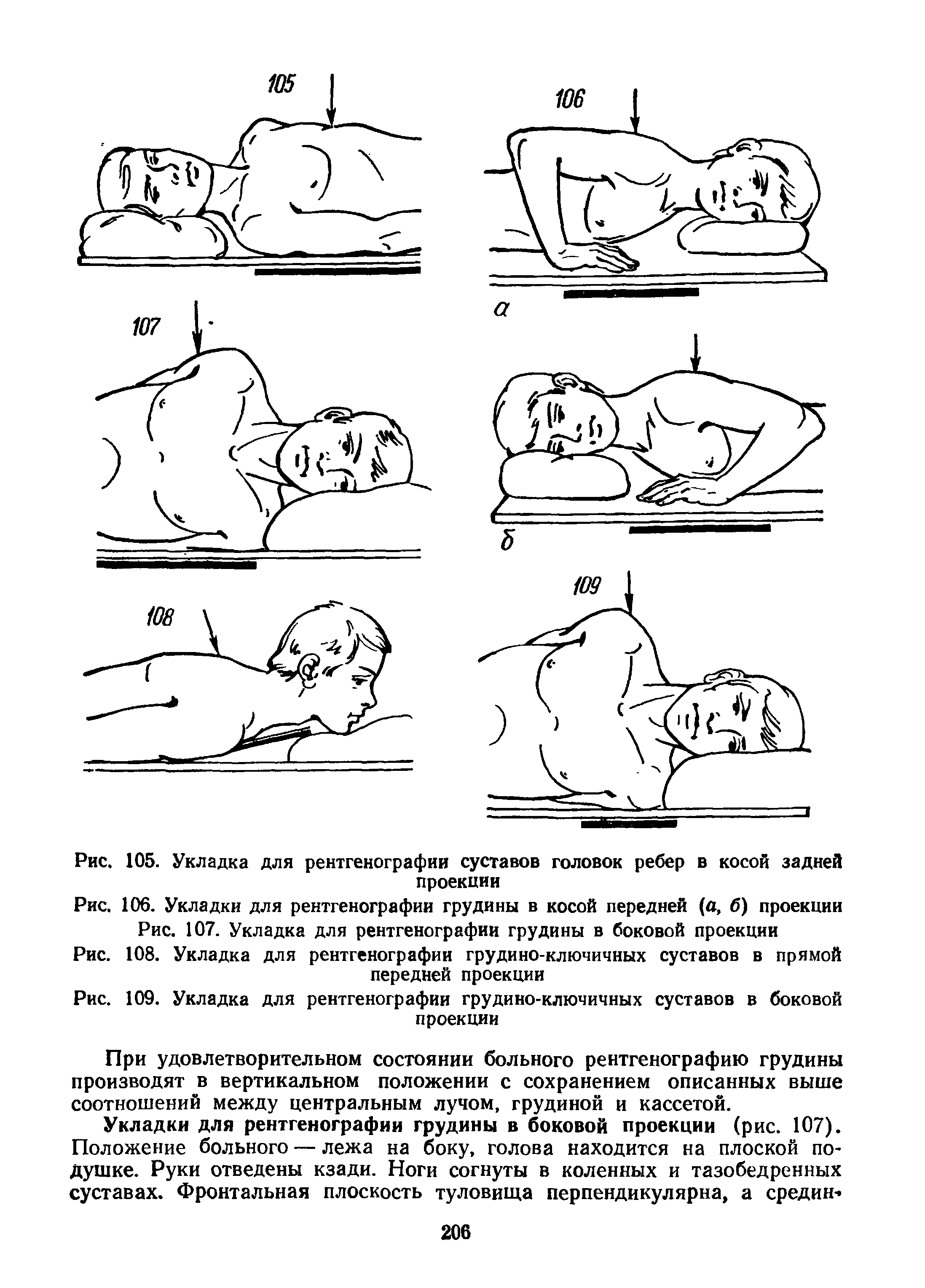 Рис. 108. Укладка для рентгенографии грудино-ключичных суставов в прямой передней проекции...