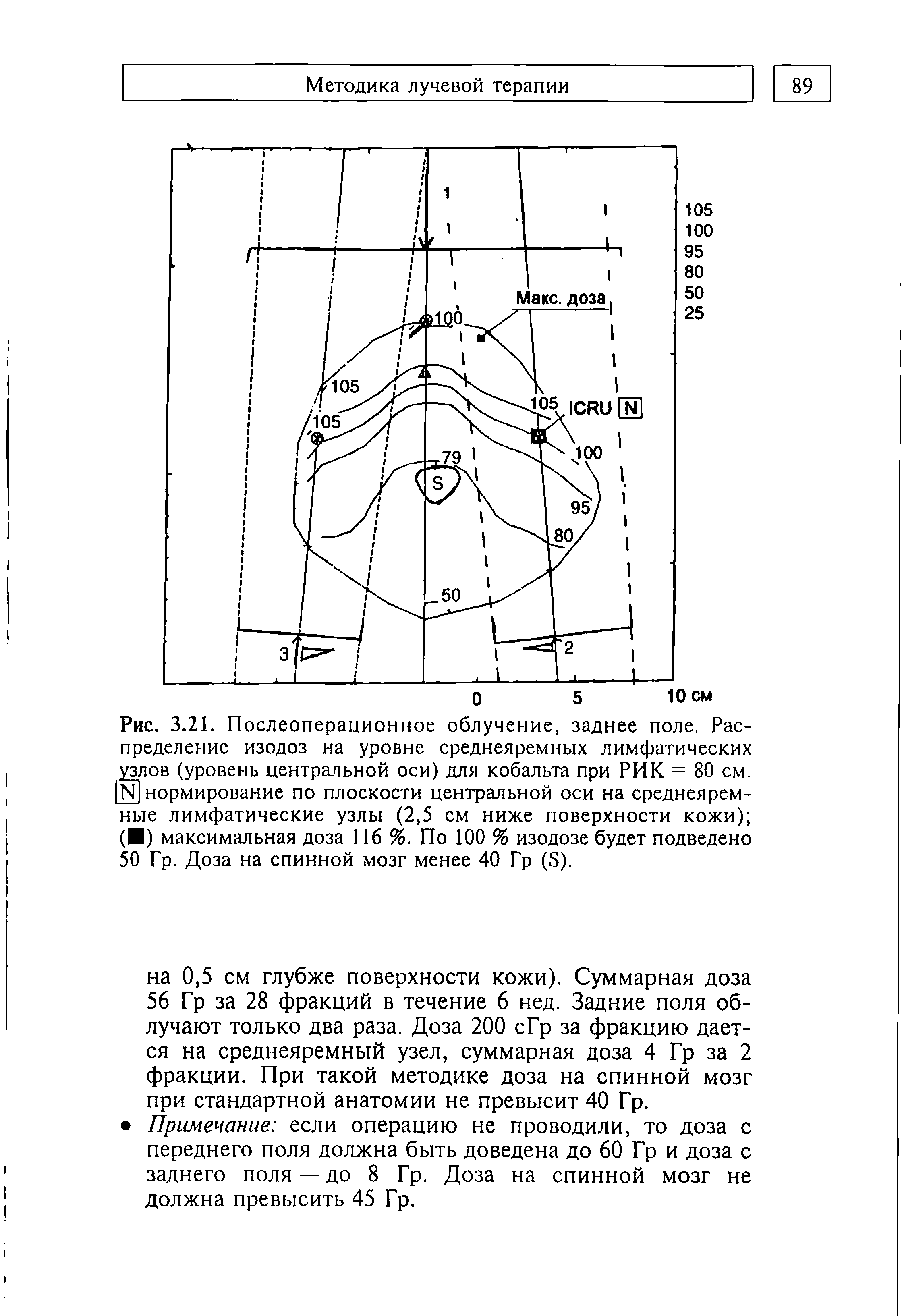 Рис. 3.21. Послеоперационное облучение, заднее поле. Распределение изодоз на уровне среднеяремных лимфатических узлов (уровень центральной оси) для кобальта при РИК. = 80 см. N1 нормирование по плоскости центральной оси на среднеяремные лимфатические узлы (2,5 см ниже поверхности кожи) ( ) максимальная доза 116%. По 100 % изодозе будет подведено 50 Гр. Доза на спинной мозг менее 40 Гр (5).