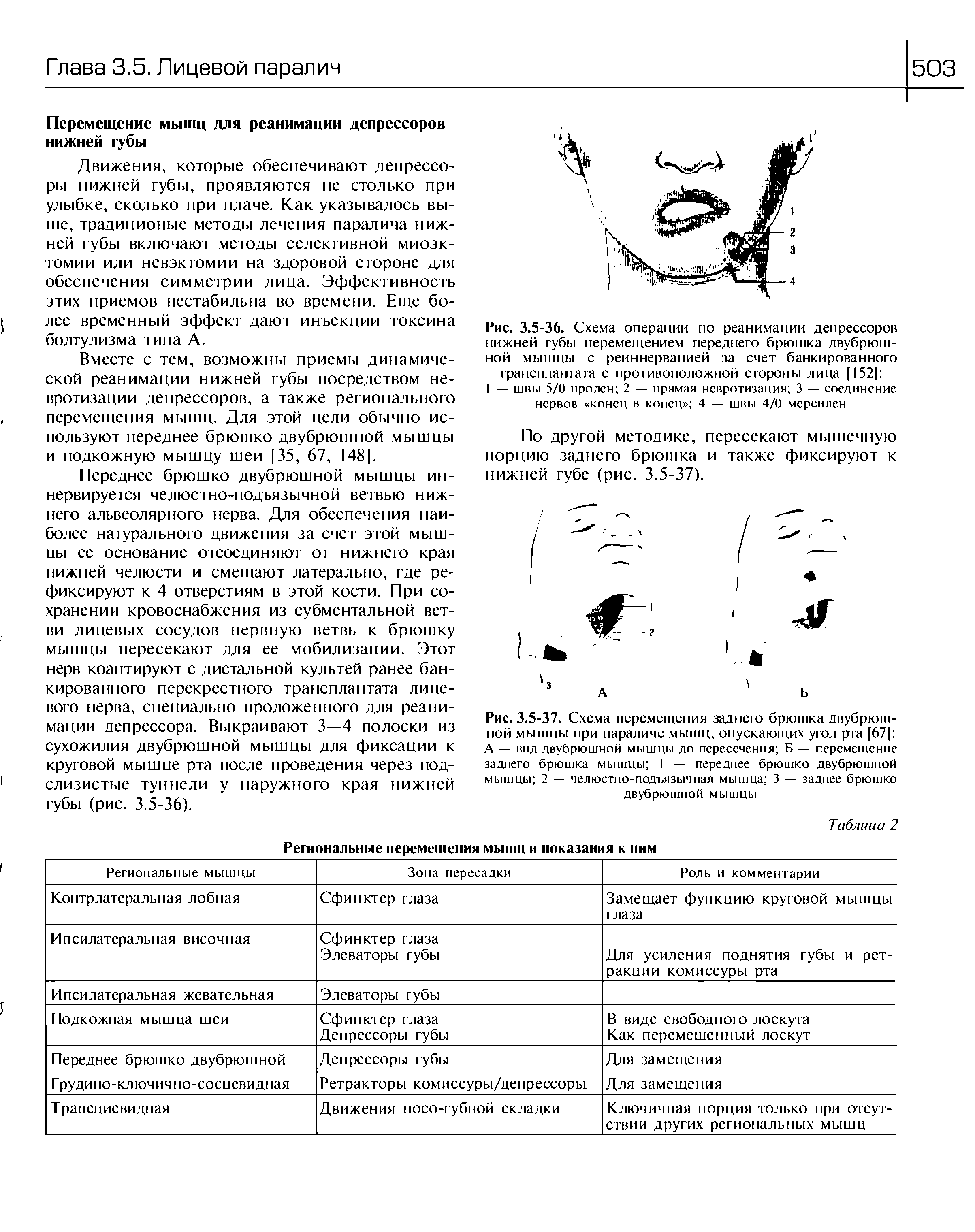 Рис. 3.5-37. Схема перемещения заднего брюшка двубрюшной мышцы при параличе мышц, опускающих угол рта [67 А — вид двубрюшной мышцы до пересечения Б — перемещение заднего брюшка мышцы I — переднее брюшко двубрюшной мышцы 2 — челюстно-подъязычная мышца 3 — заднее брюшко двубрюшной мышцы...