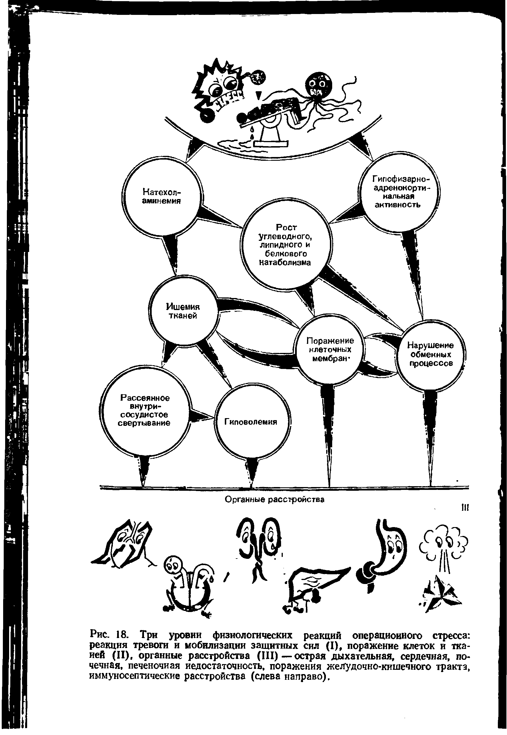 Рис. 18. Три уровни физиологических реакций операционного стресса реакция тревоги и мобилизации защитных сил (I), поражение клеток и тканей (II), органные расстройства (III)—острая дыхательная, сердечная, почечная, печеночная недостаточность, поражения желудочно-кишечного тракта, иммуносептические расстройства (слева направо).