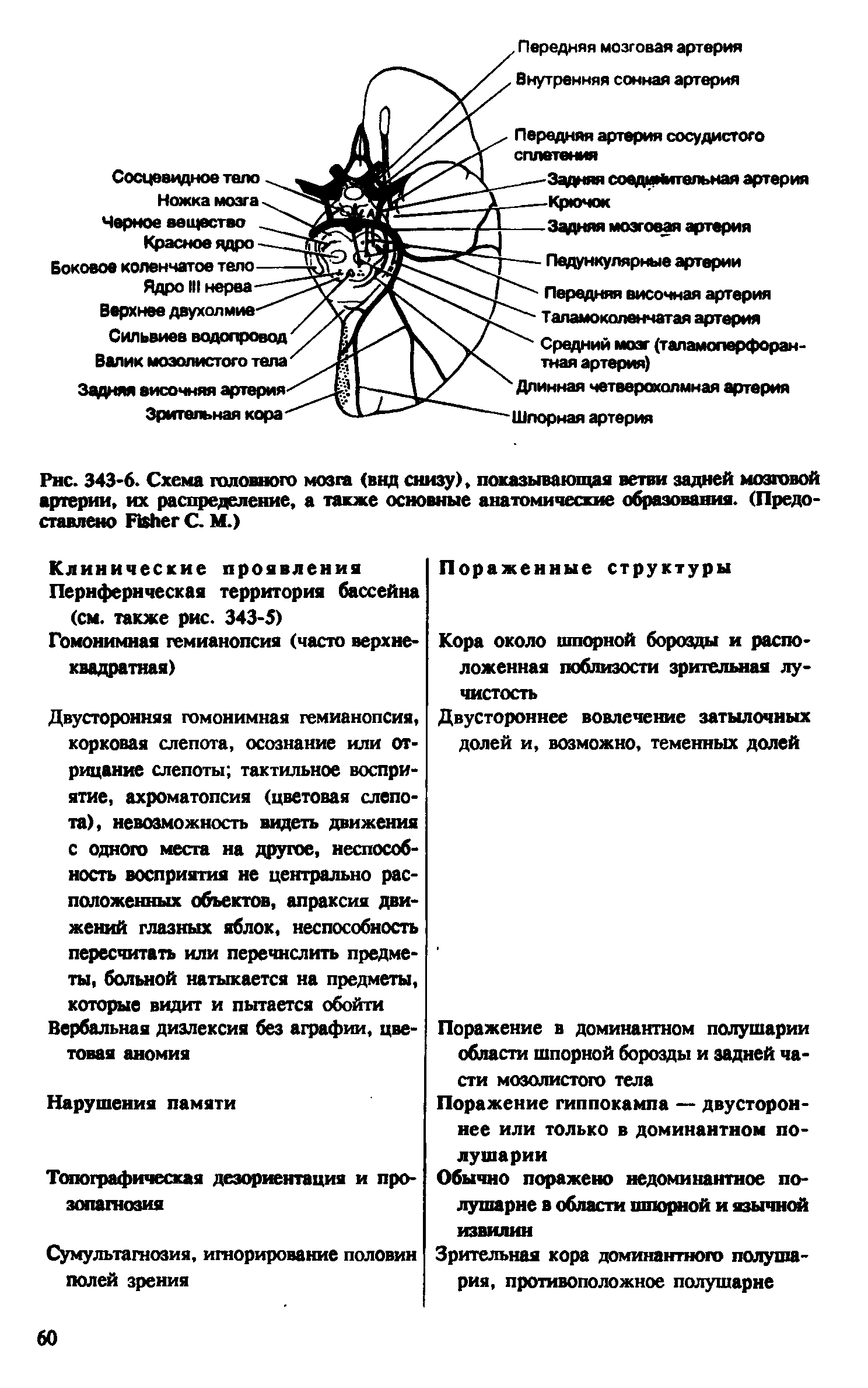 Рис. 343-6. Схема головного мозга (внд снизу), показывающая ветви задней мозговой артерии, их распределение, а также основные анатомические образования. (Предоставлено F С. М.)...