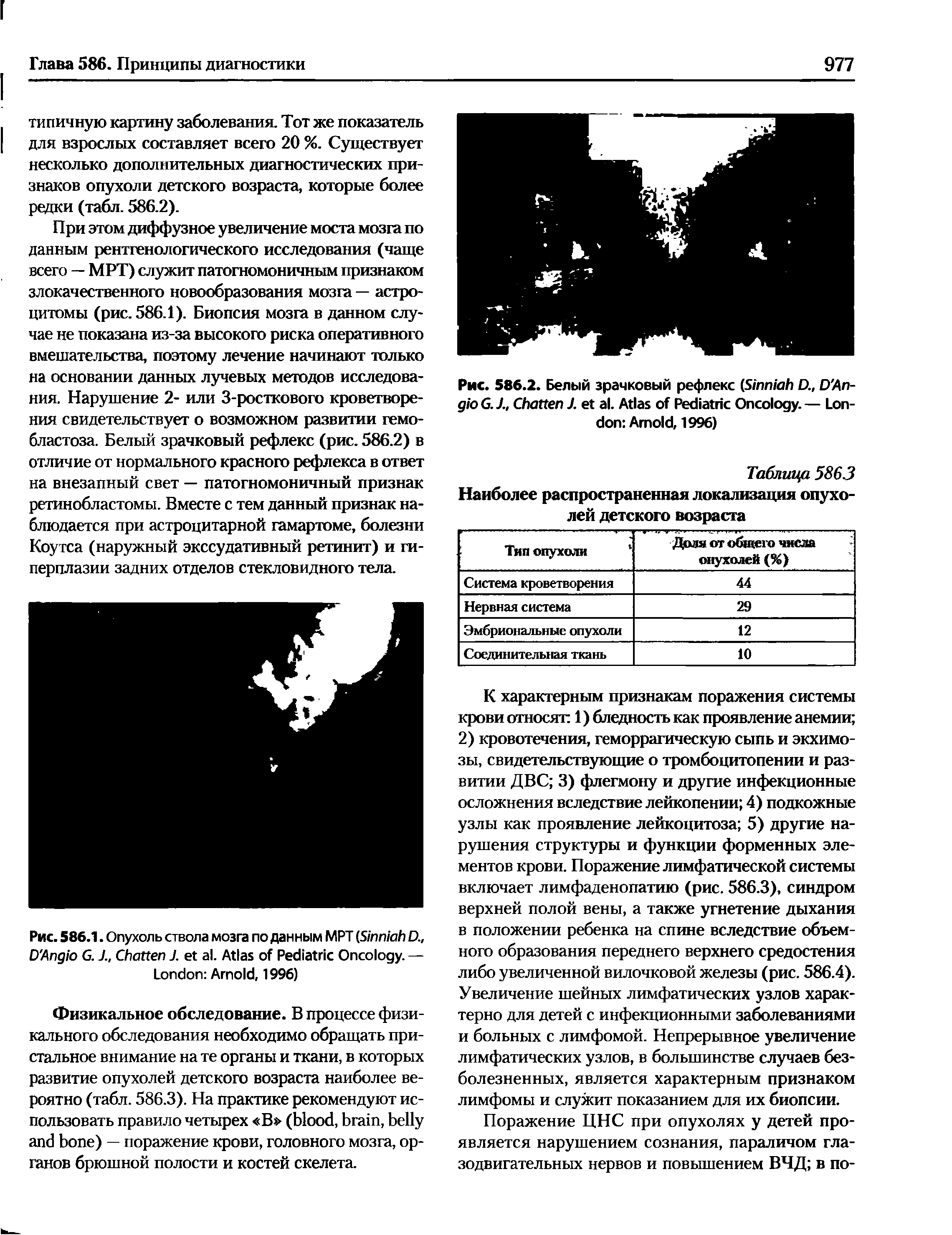 Рис. 586.2. Белый зрачковый рефлекс (S D., D A - G.J., C J. . A P O .— L A , 1996)...