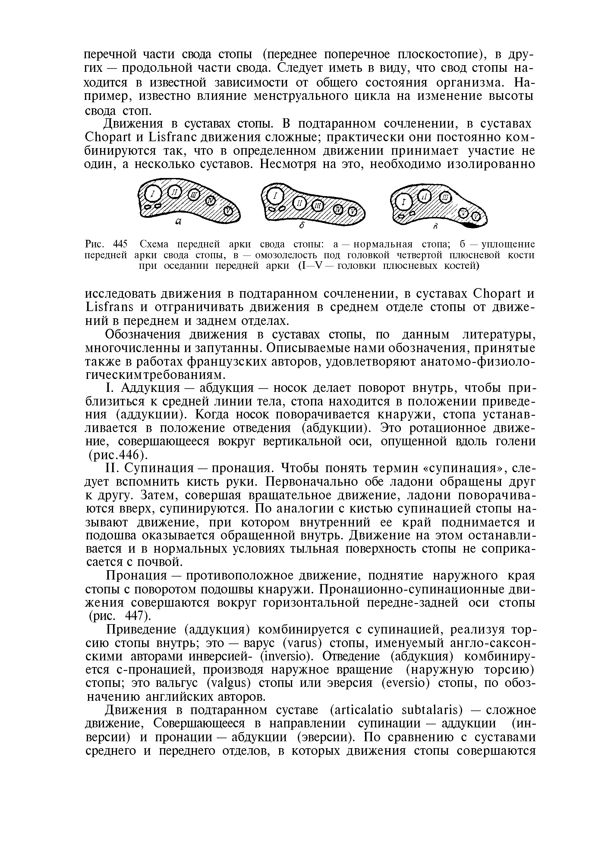 Рис. 445 Схема передней арки свода стопы а — нормальная стопа б — уплощение передней арки свода стопы, в — омозолелость под головкой четвертой плюсневой кости при оседании передней арки (I—V — головки плюсневых костей)...