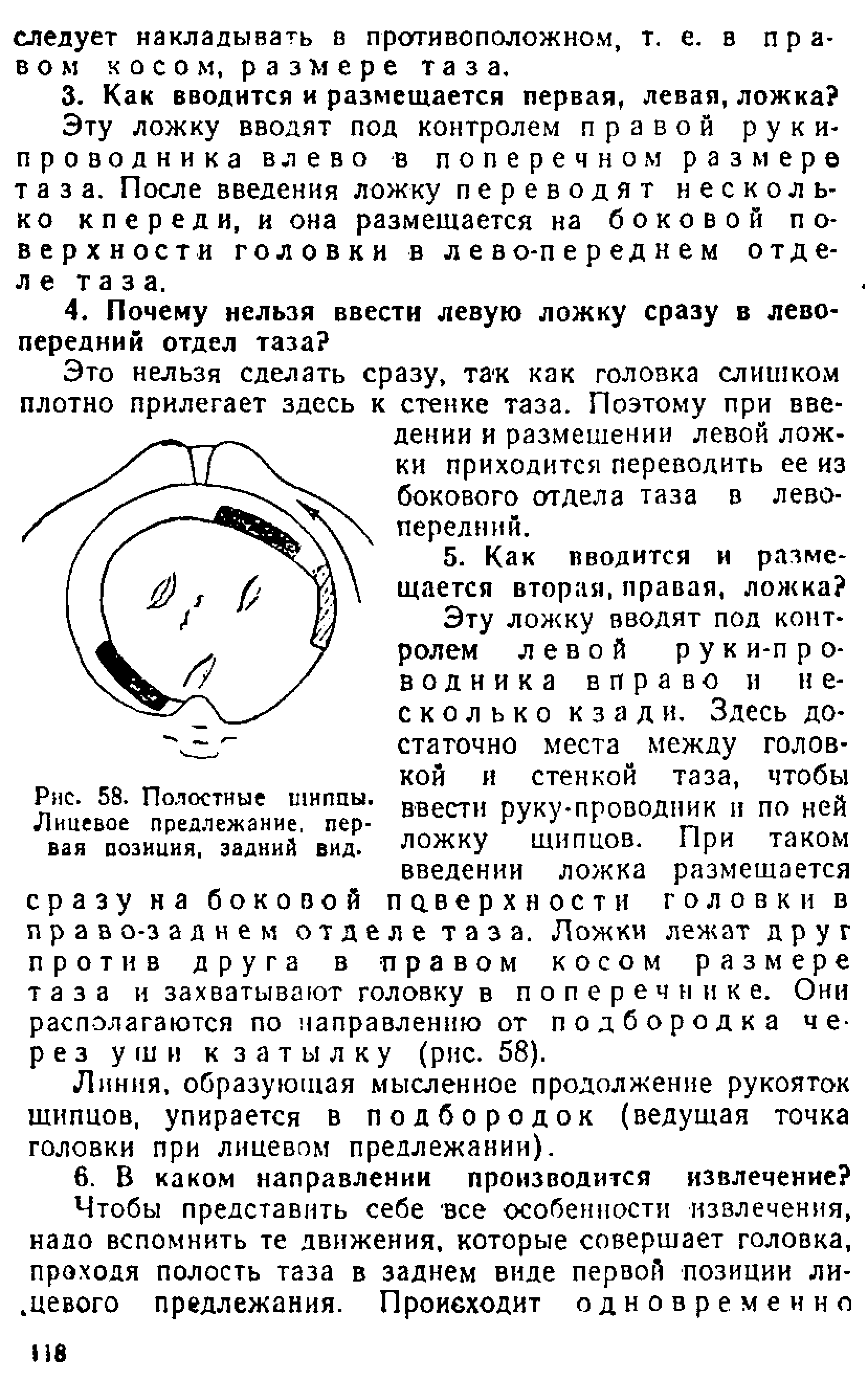 Рис. 58. Полостные шнппы. Лицевое предлежание, первая позиция, задний вид.