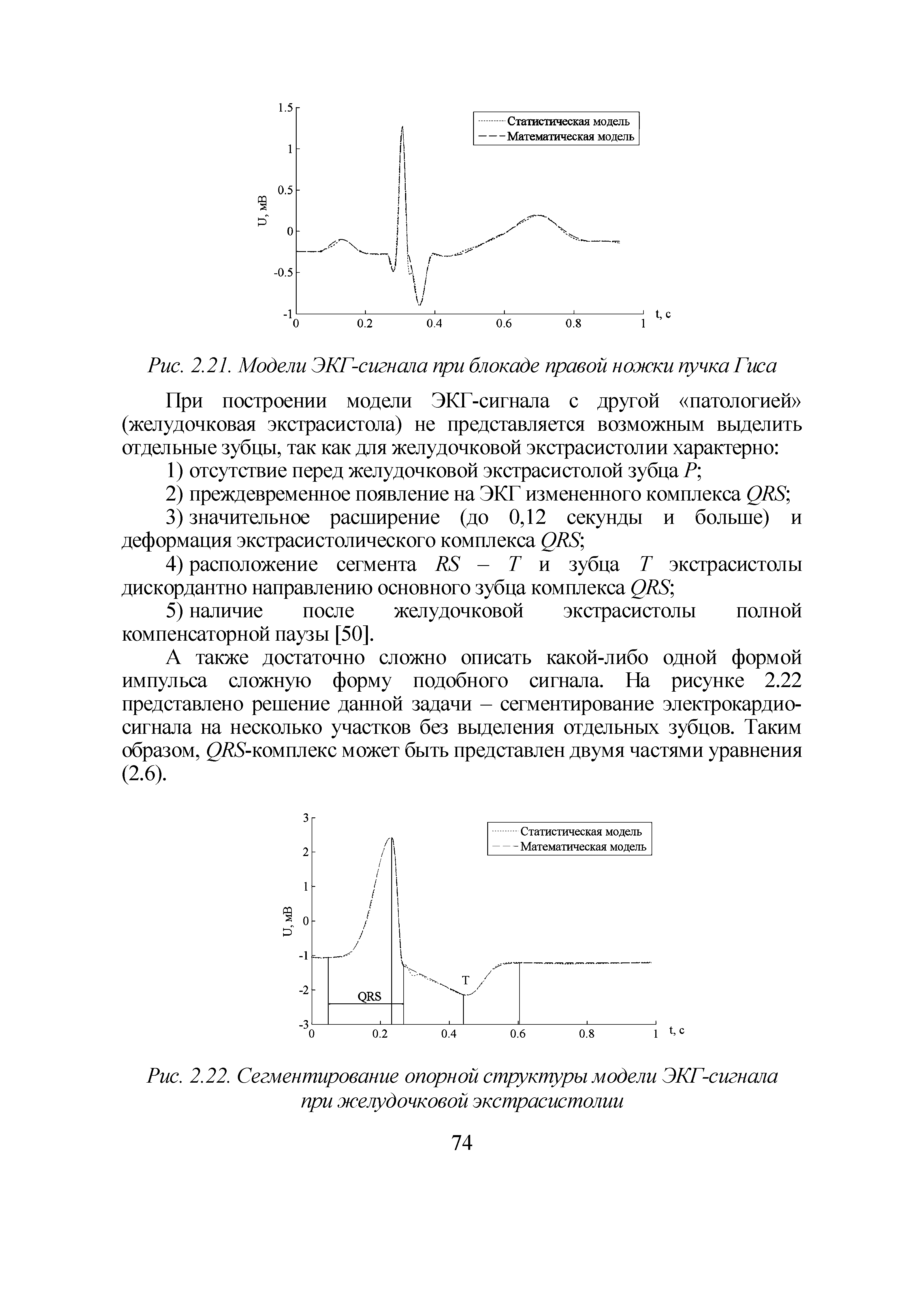 Рис. 2.22. Сегментирование опорной структуры модели ЭКГ-сигнала при желудочковой экстрасистолии...