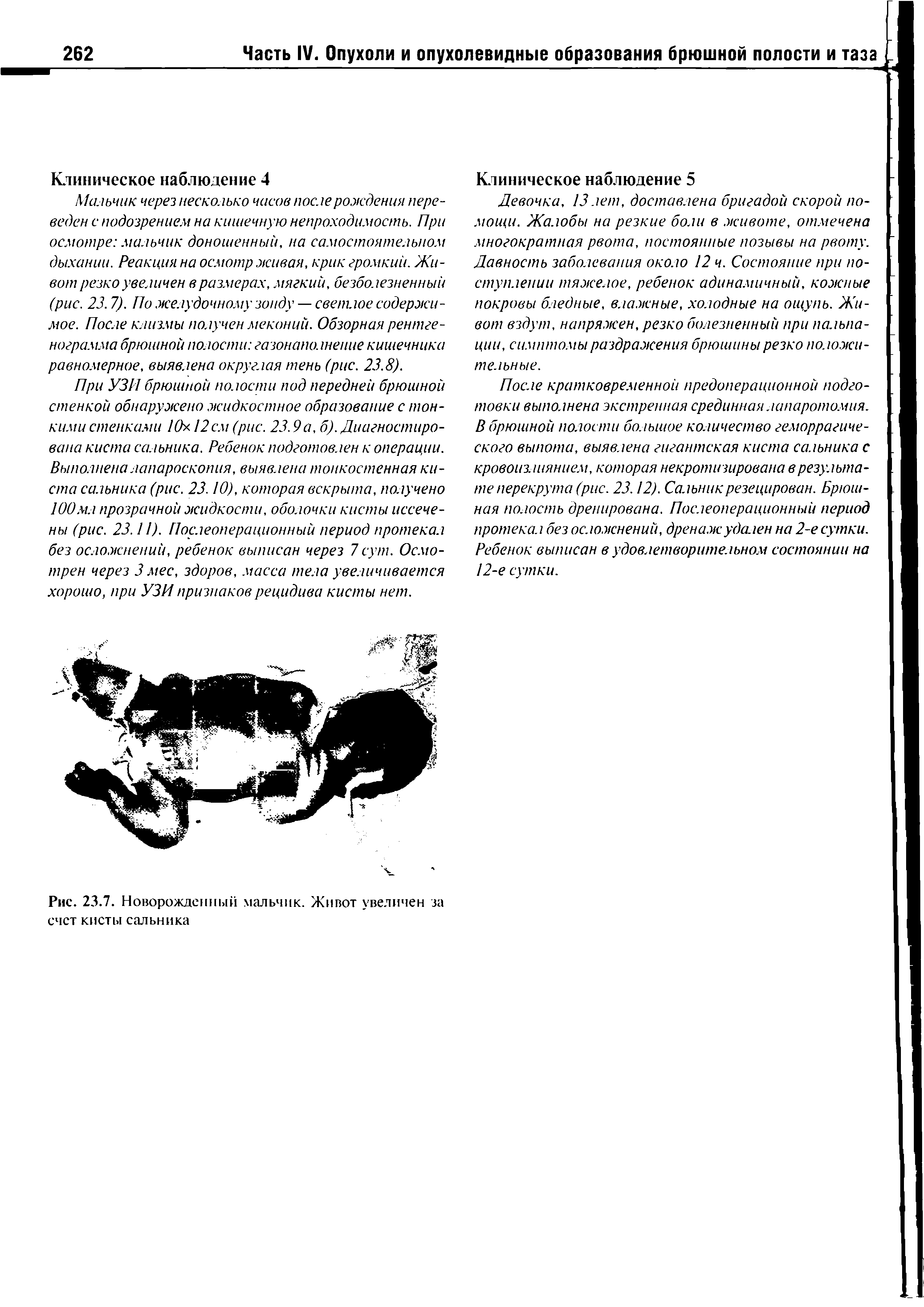 Рис. 23.7. Новорожденный мальчик. Живот увеличен за счет кисты сальника...