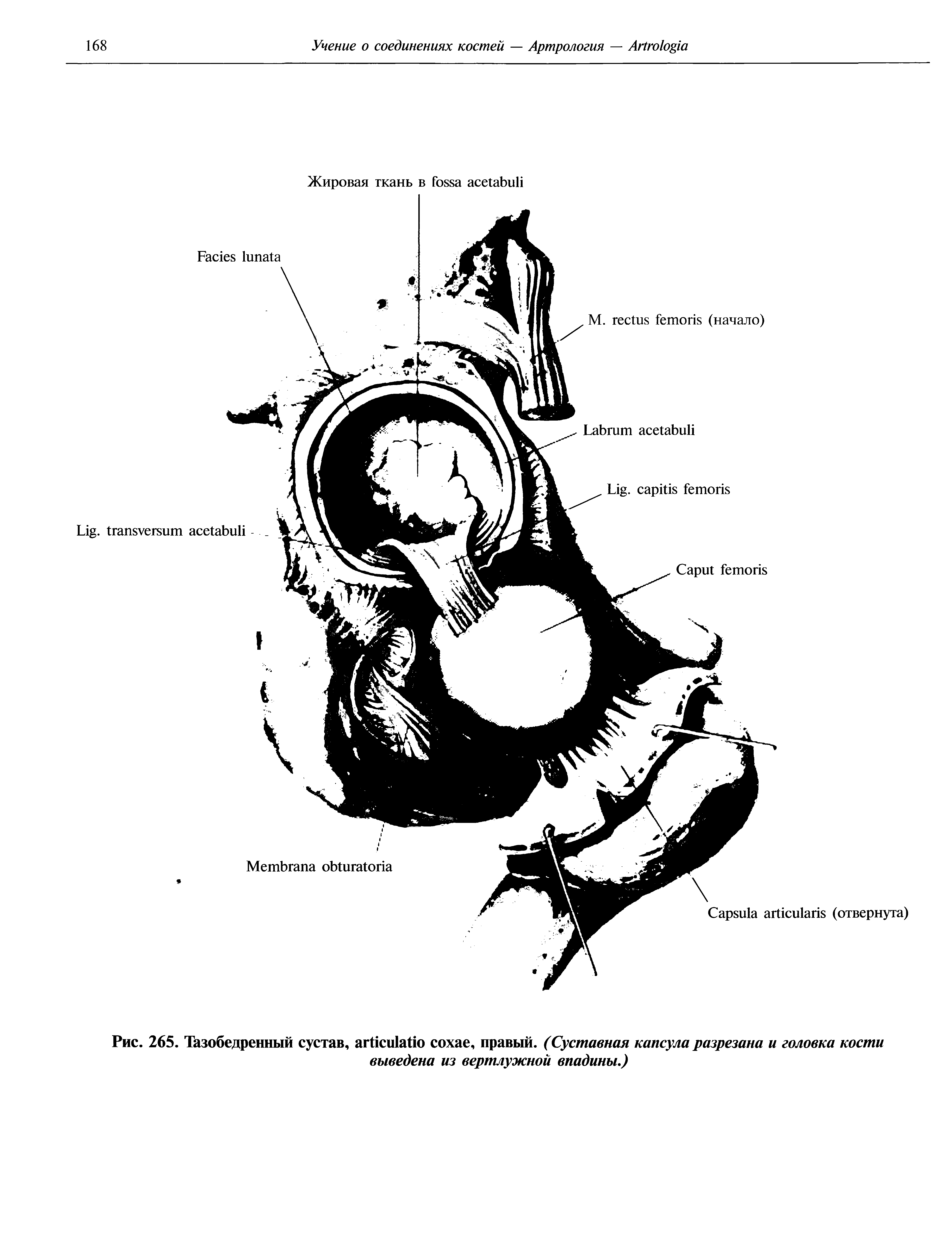 Рис. 265. Тазобедренный сустав, , правый. (Суставная капсула разрезана и головка кости выведена из вертлужной впадины.)...