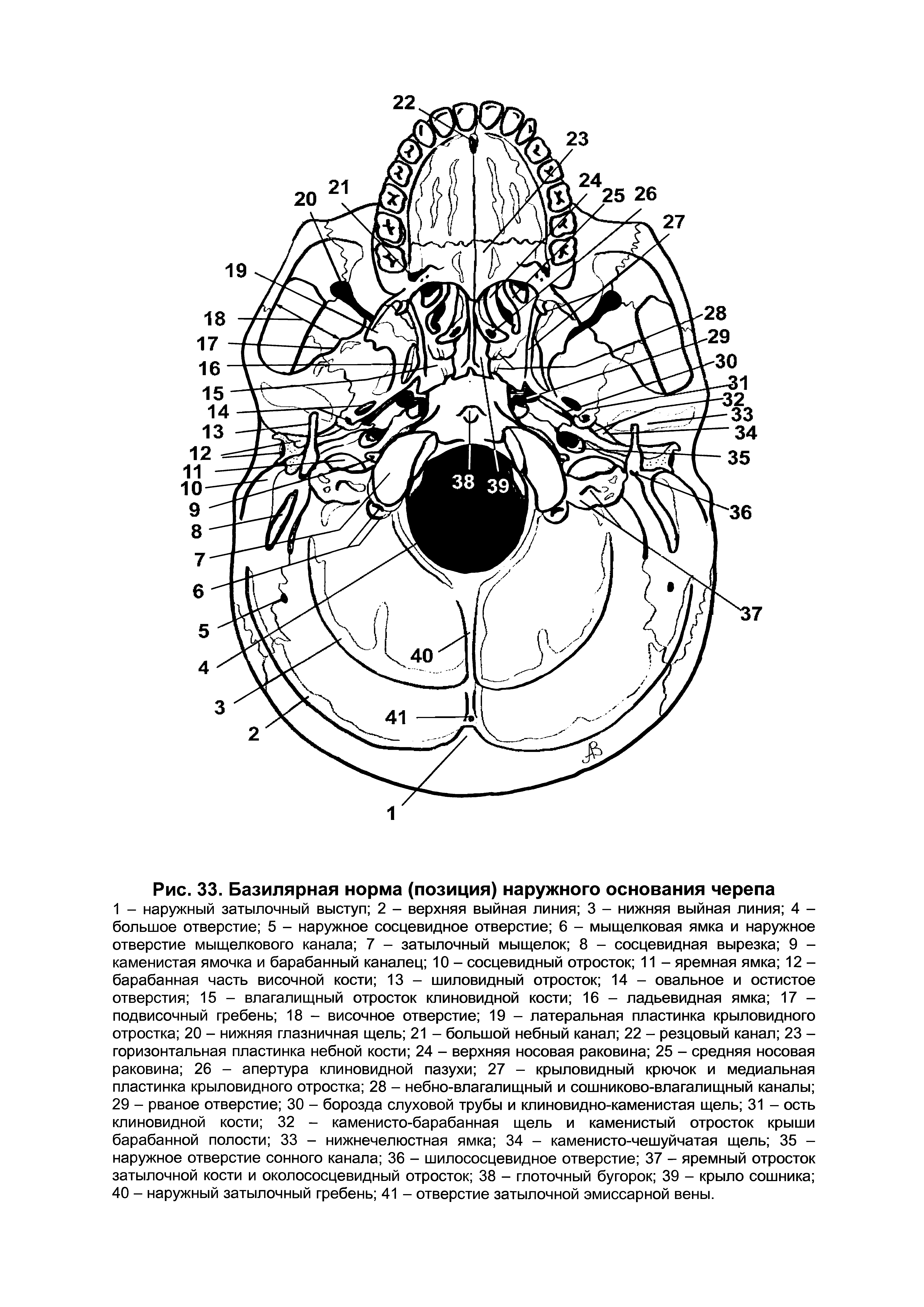 Рис. 33. Базилярная норма (позиция) наружного основания черепа...