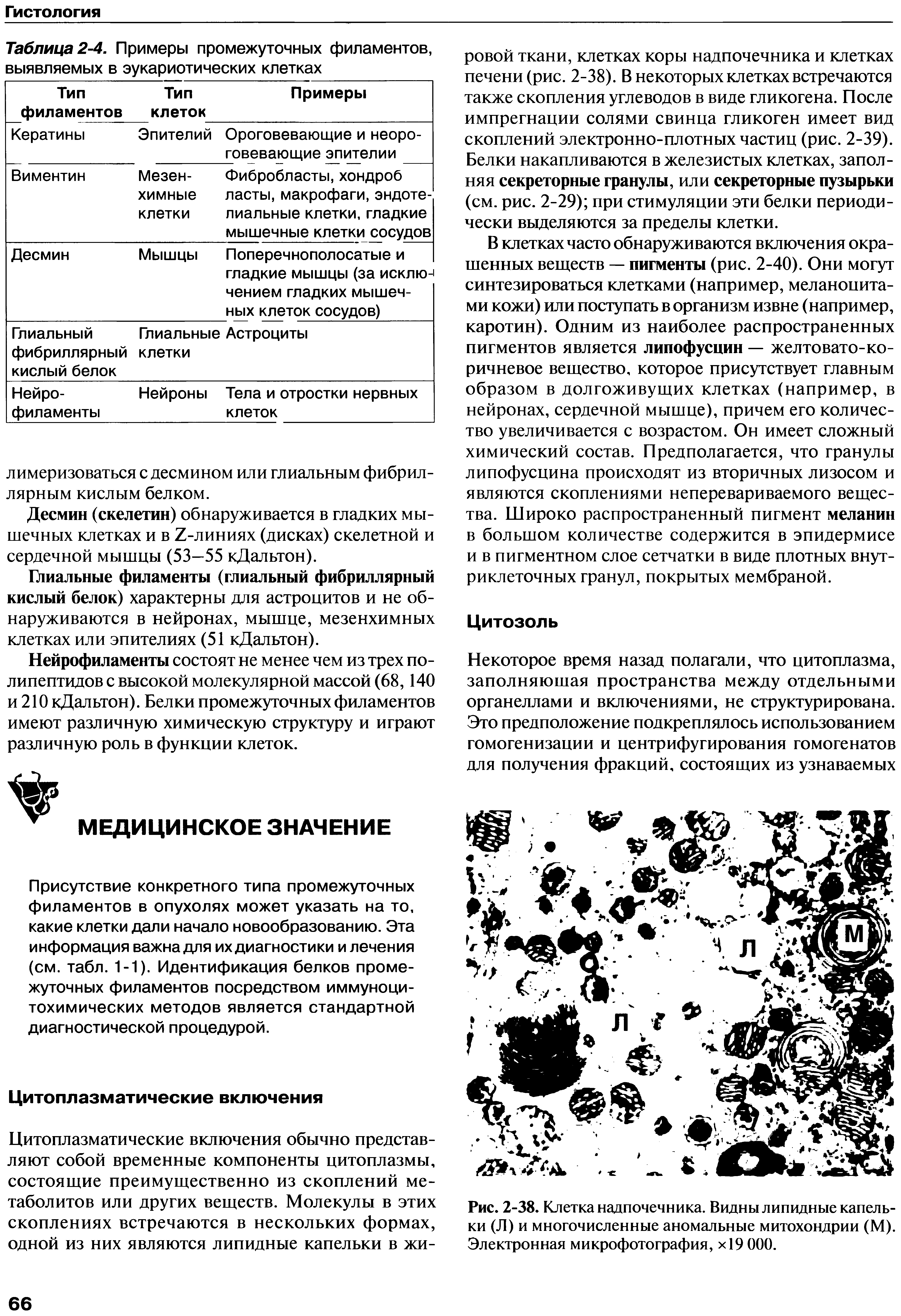 Рис. 2-38. Клетка надпочечника. Видны липидные капельки (Л) и многочисленные аномальные митохондрии (М). Электронная микрофотография, х19 ООО.