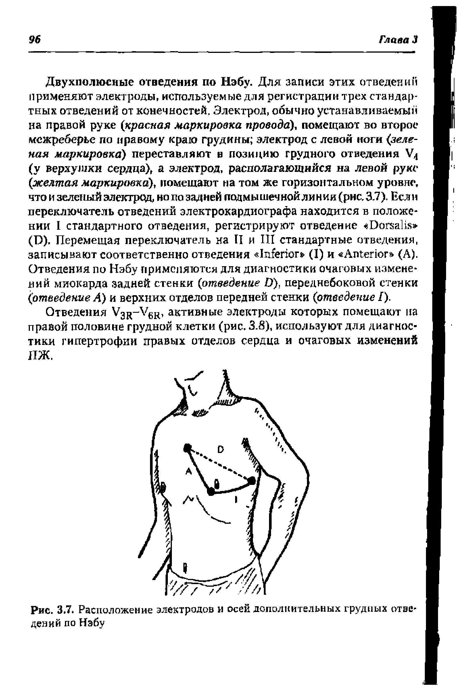 Рис. 3.7. Расположение электродов и осей дополнительных грудных отведений по Нэбу...