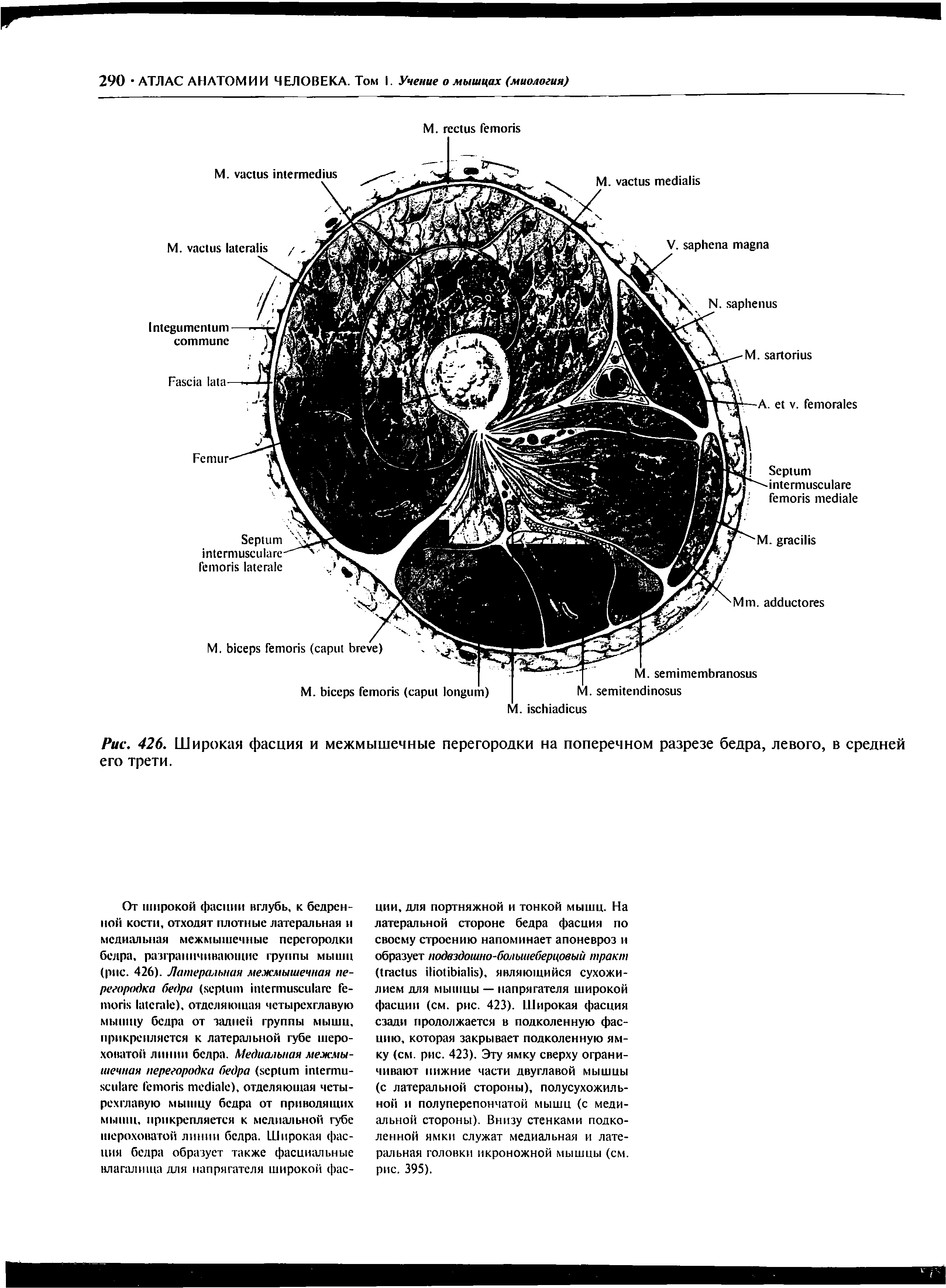 Рис. 426. Широкая фасция и межмышечные перегородки на поперечном разрезе бедра, левого, в средней его трети.