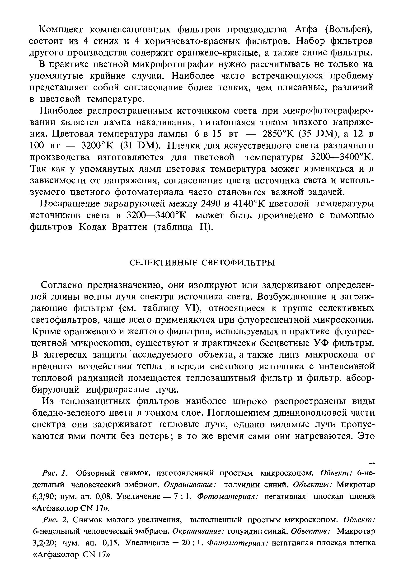 Рис. I. Обзорный снимок, изготовленный простым микроскопом. Объект 6-недельный человеческий эмбрион. Окрашивание толуидин синий. Объектив Микротар 6,3/90 нум. ап. 0,08. Увеличение = 7 1. Фотоматериал негативная плоская пленка Агфаколор СМ 17 .