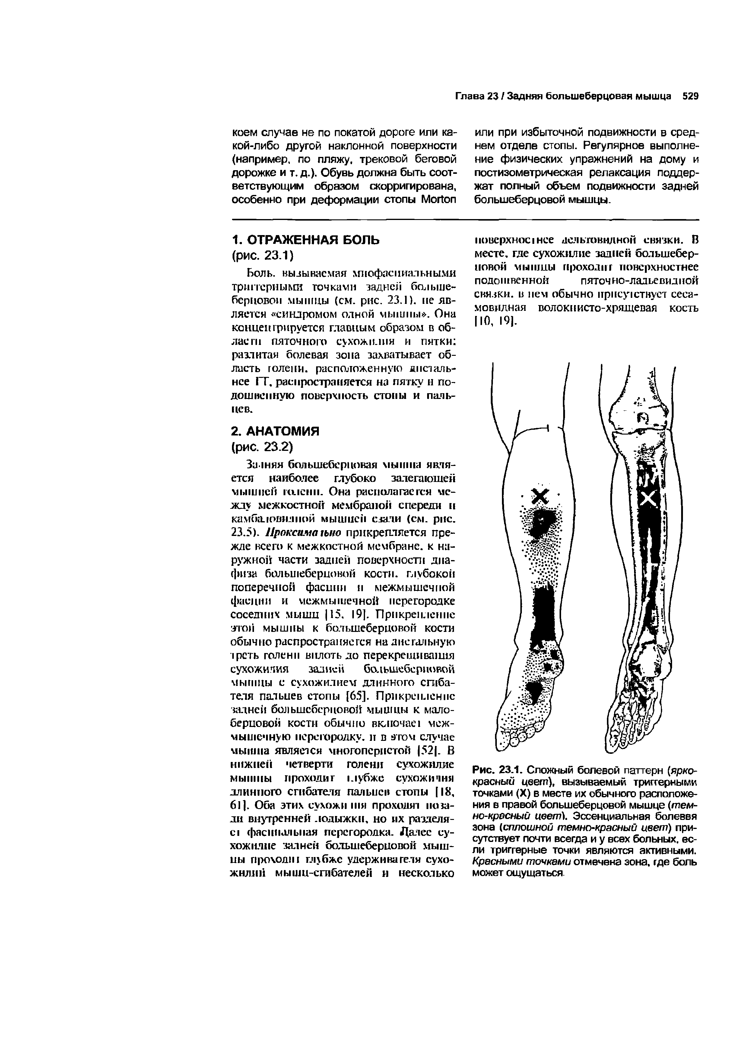 Рис. 23.1. Сложный болевой паттерн (ярко-красный цвет), вызываемый триггерными точками (X) в месте их обычного расположения в правой большеберцовой мышце (темно-красный цвет). Эссенциальная болеввя зона (сплошной темнокрасный цвет) присутствует почти всегда и у всех больных, если триггерные точки являются активными. Красными точками отмечена зона, где боль может ощущаться...