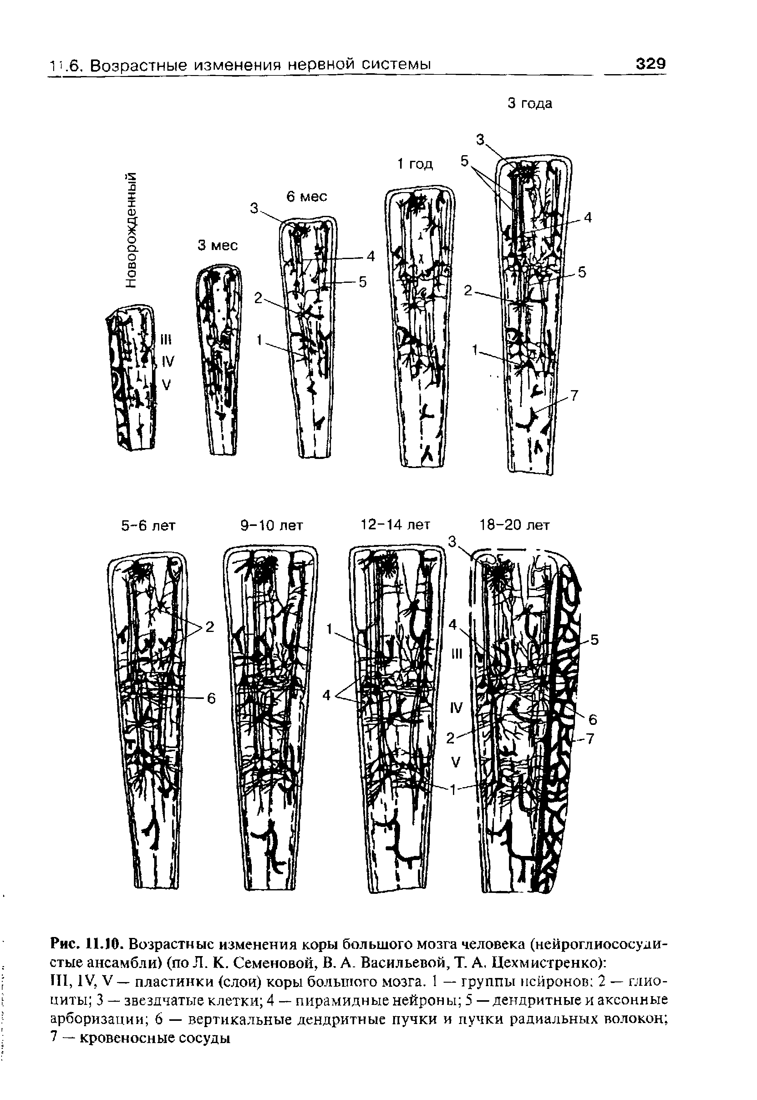 Рис. 11.10. Возрастные изменения коры большого мозга человека (нейроглиососуди-стые ансамбли) (по Л. К. Семеновой. В, А. Васильевой, Т. А. Цехмистренко) ...