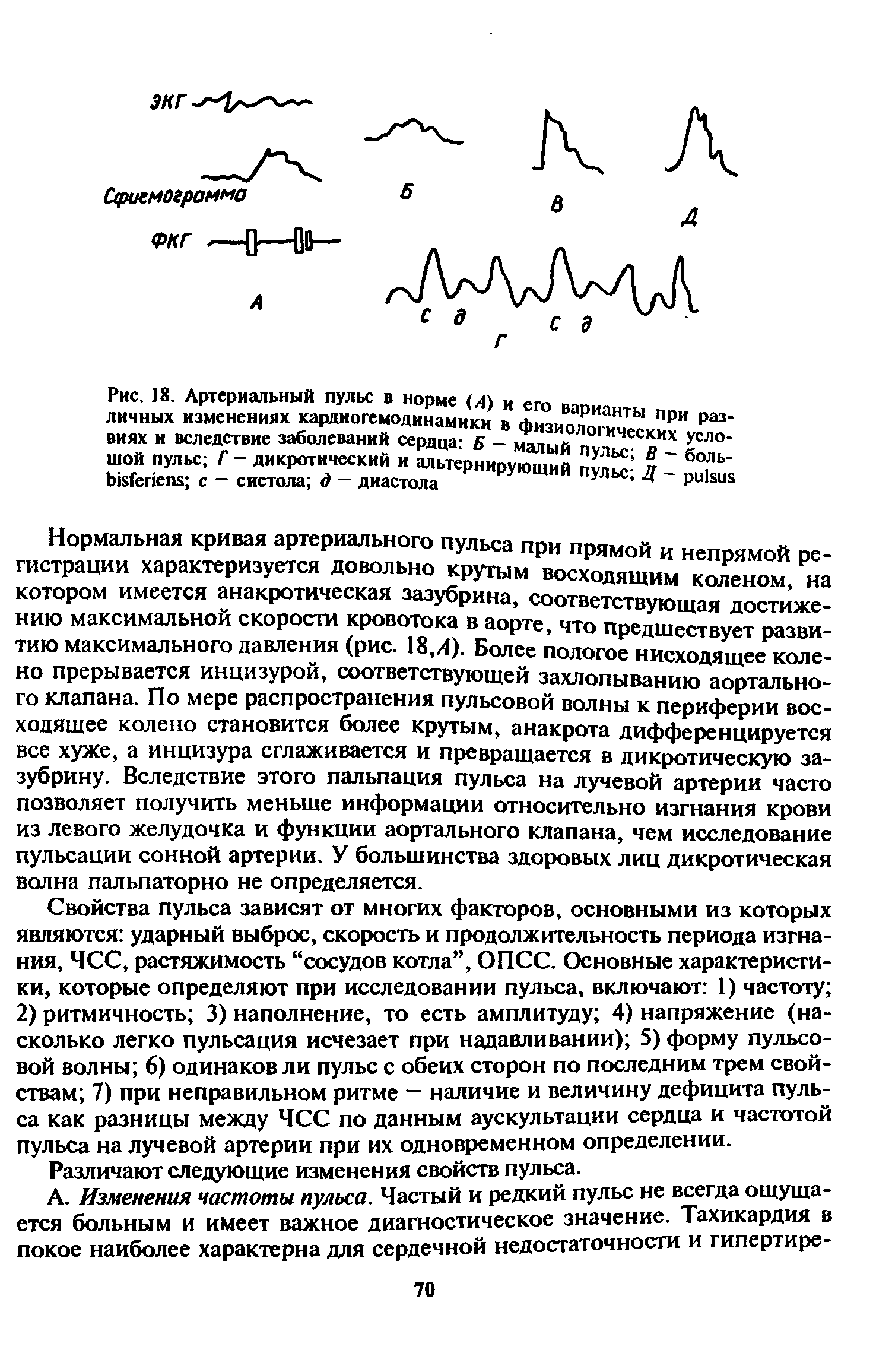 Рис. 18. Артериальный пульс в норме (Д) и его варианты пои личных изменениях кардиогемодинамики в Физиологических T ВИЯХ и вследствие заболевании сердца Б - малый пульс л- к шой пульс Г - дикротический и альтернирующий пульс Д - Хч с — систола о — диастола ршьиь...