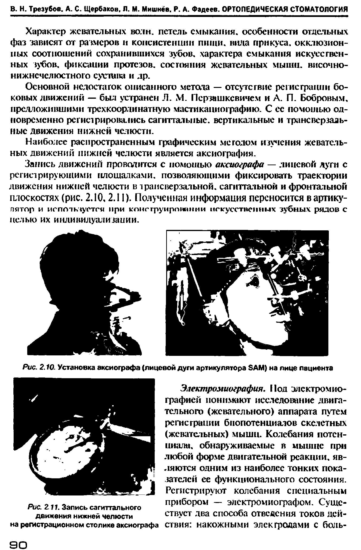 Рис. 2.10. Установка аксиографа (лицевой дуги артикулятора SAM) на лице пациента...