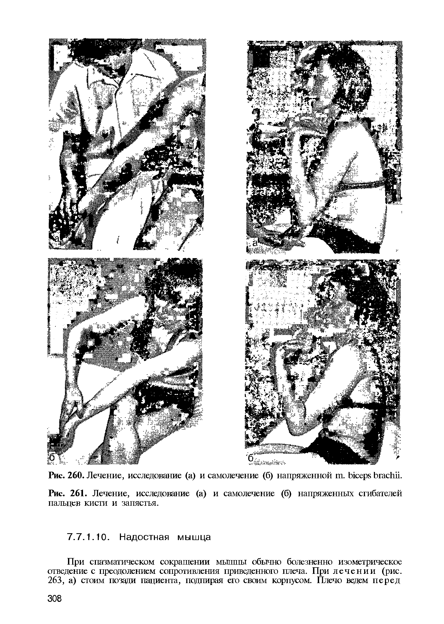 Рис. 261. Лечение, исследование (а) и самолечение (б) напряженных сгибателей пальцев кисти и запястья.