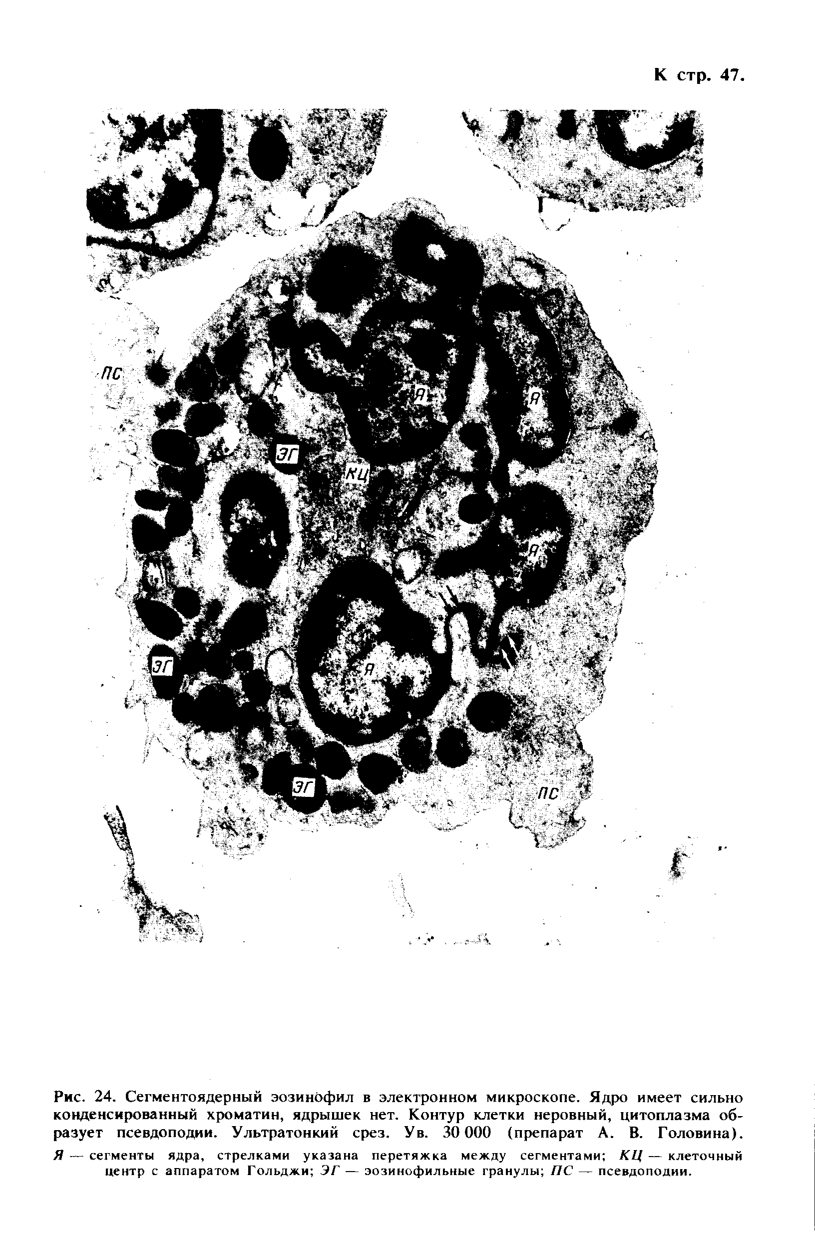 Рис. 24. Сегментоядерный эозинофил в электронном микроскопе. Ядро имеет сильно конденсированный хроматин, ядрышек нет. Контур клетки неровный, цитоплазма образует псевдоподии. Ультратонкий срез. Ув. 30 000 (препарат А. В. Головина). Я — сегменты ядра, стрелками указана перетяжка между сегментами КЦ — клеточный центр с аппаратом Гольджи ЭГ — эозинофильные гранулы ПС — псевдоподии.