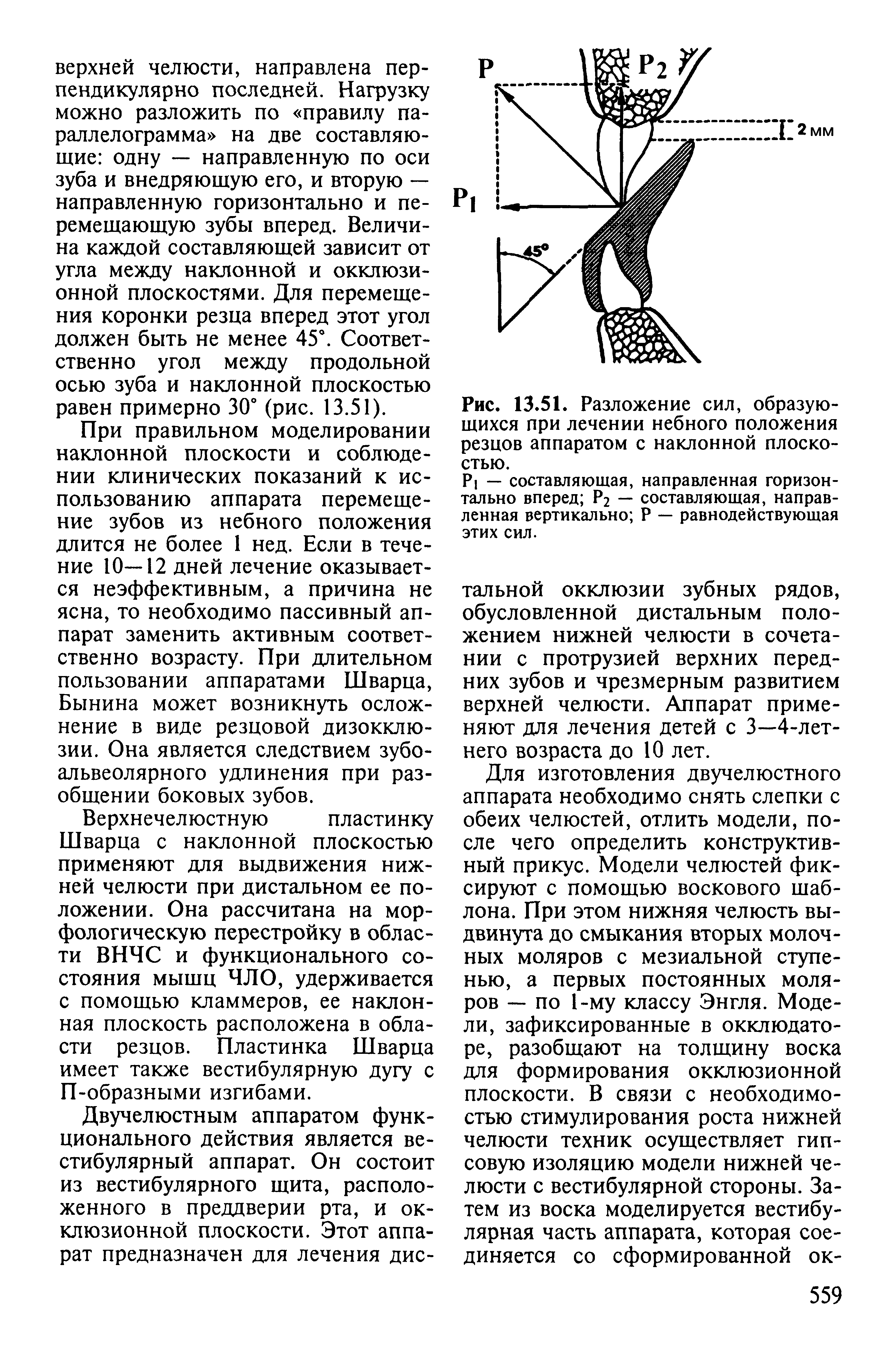 Рис. 13.51. Разложение сил, образующихся при лечении небного положения резцов аппаратом с наклонной плоскостью.