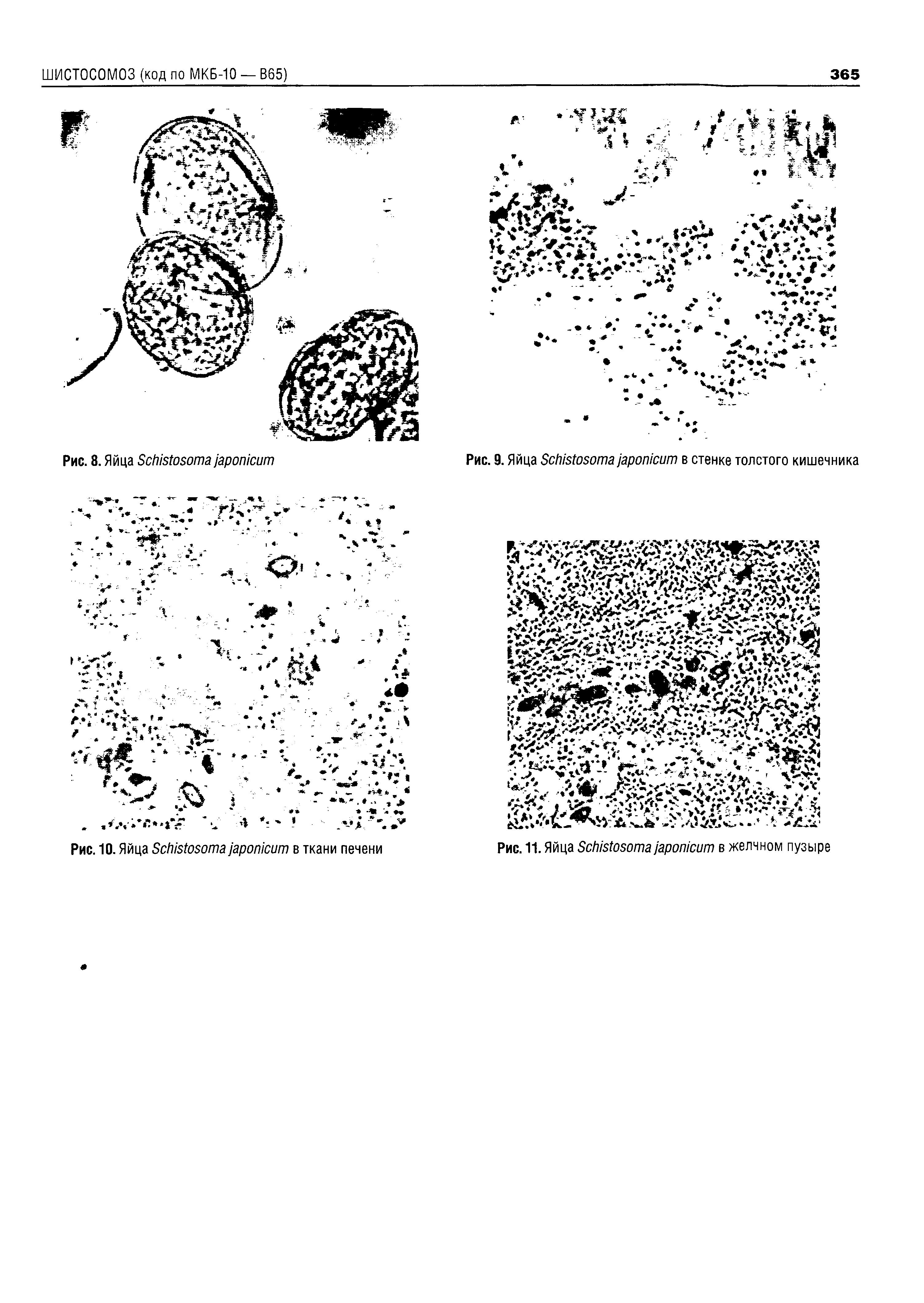 Рис. 9. Яйца S в стенке толстого кишечника...