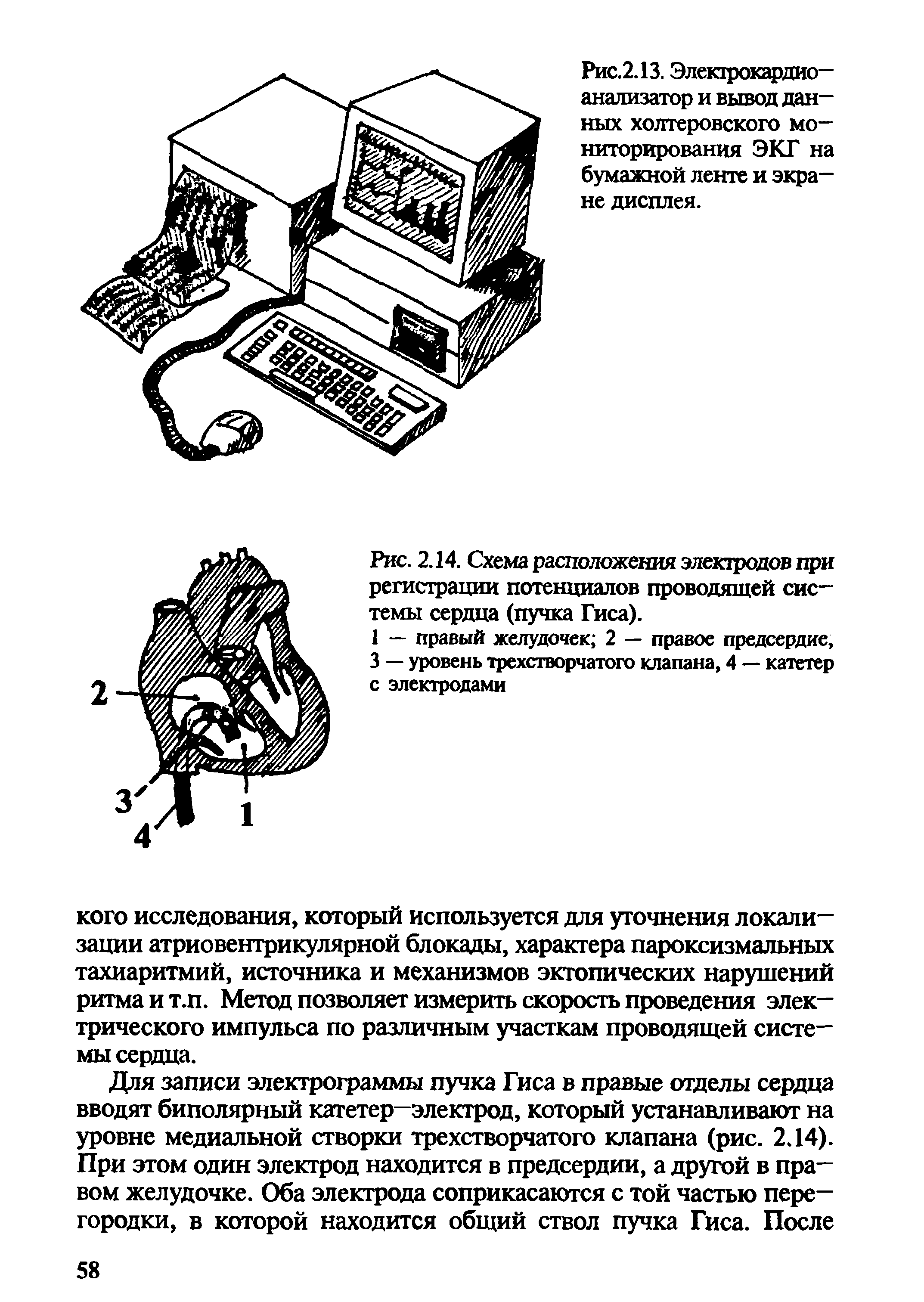 Рис. 2.14. Схема расположения электродов при регистрации потенциалов проводящей системы сердца (пучка Гиса).