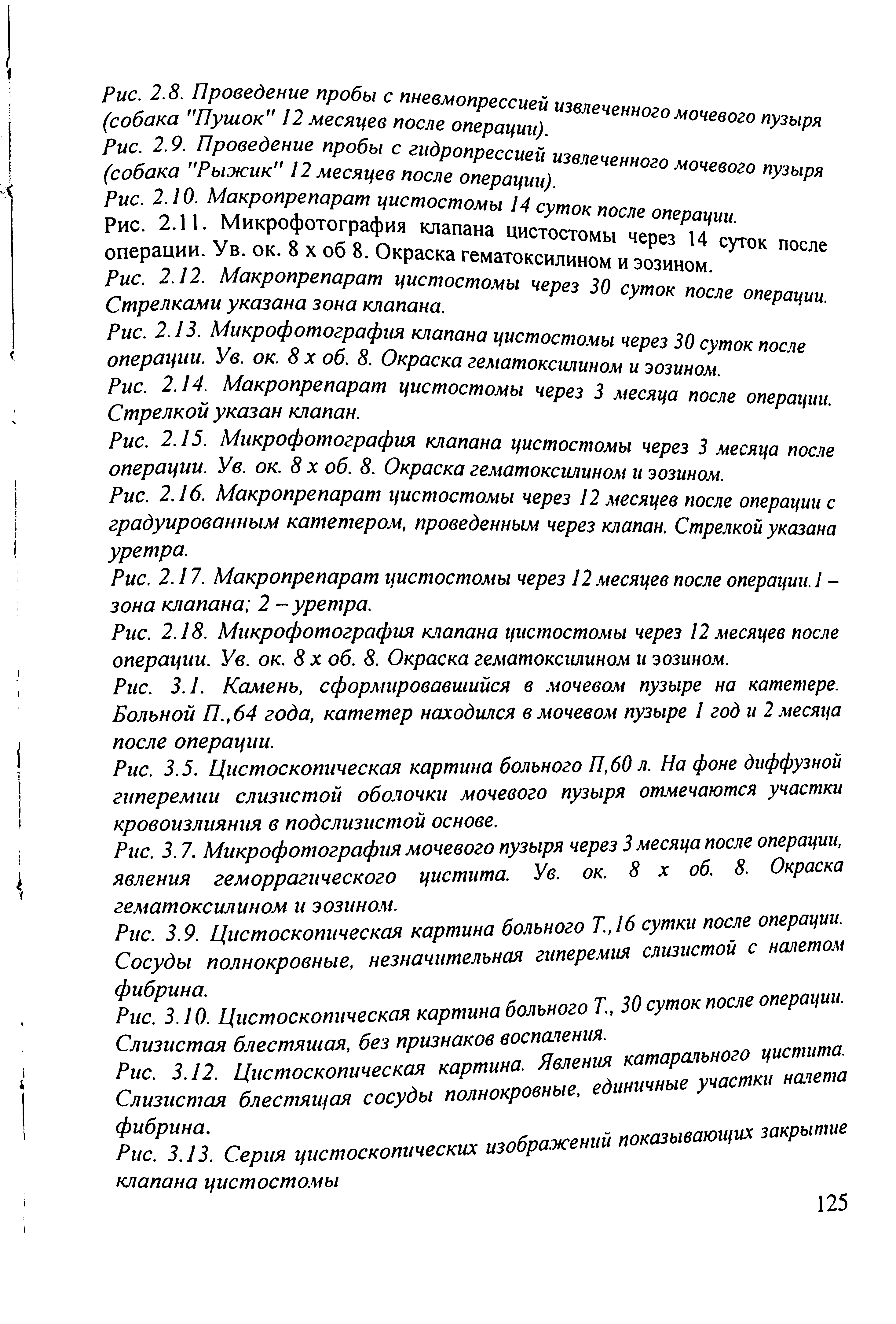 Рис. 2.16. Макропрепарат цистостомы через 12 месяцев после операции с градуированным катетером, проведенным через клапан. Стрелкой указана уретра.