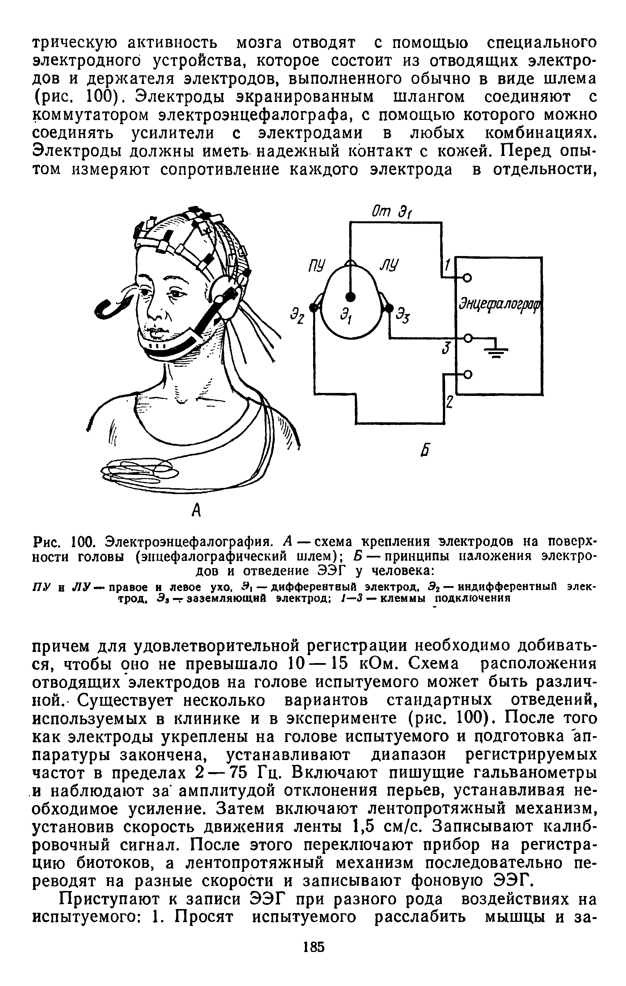 Рис. 100. Электроэнцефалография. А—схема крепления электродов на поверхности головы (энцефалографический шлем) Б — принципы наложения электродов и отведение ЭЭГ у человека ...