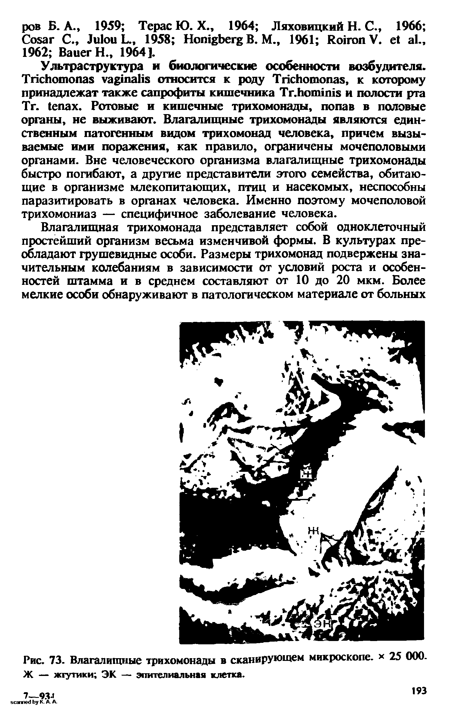 Рис. 73. Влагалищные трихомонады в сканирующем микроскопе. 25 000. Ж — жгутики ЭК — эпителиальная клетка.