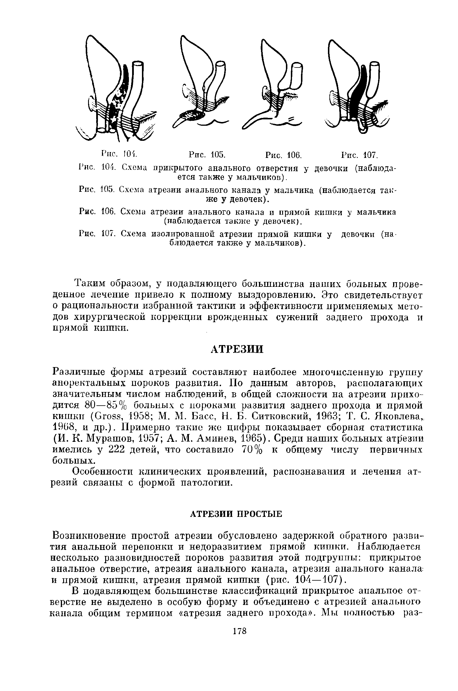 Рис. 105. Схема атрезии анального канала у мальчика (наблюдается также у девочек).