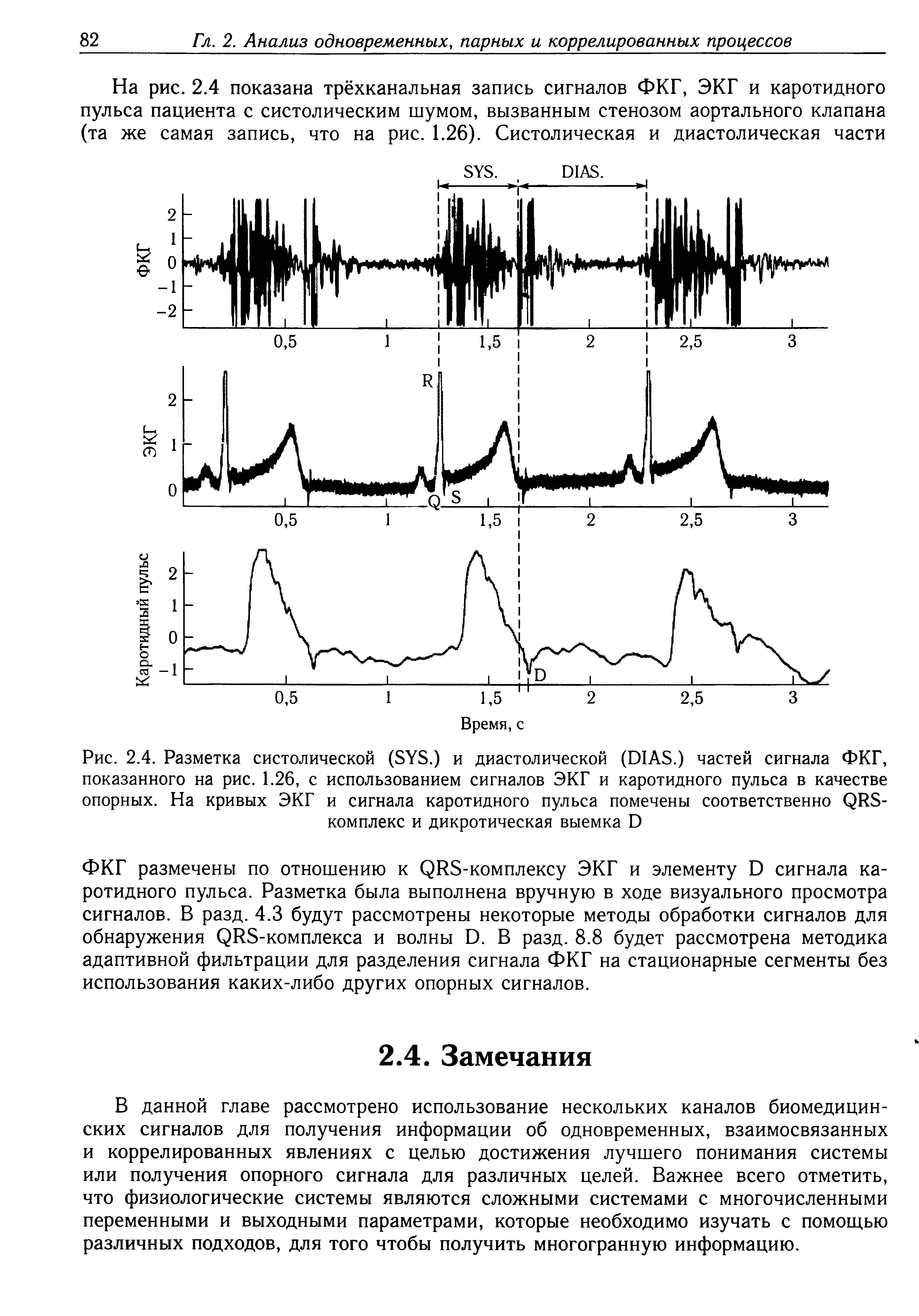 Рис. 2.4. Разметка систолической (SYS.) и диастолической (DIAS.) частей сигнала ФКГ, показанного на рис. 1.26, с использованием сигналов ЭКГ и каротидного пульса в качестве опорных. На кривых ЭКГ и сигнала каротидного пульса помечены соответственно QRS-комплекс и дикротическая выемка D...