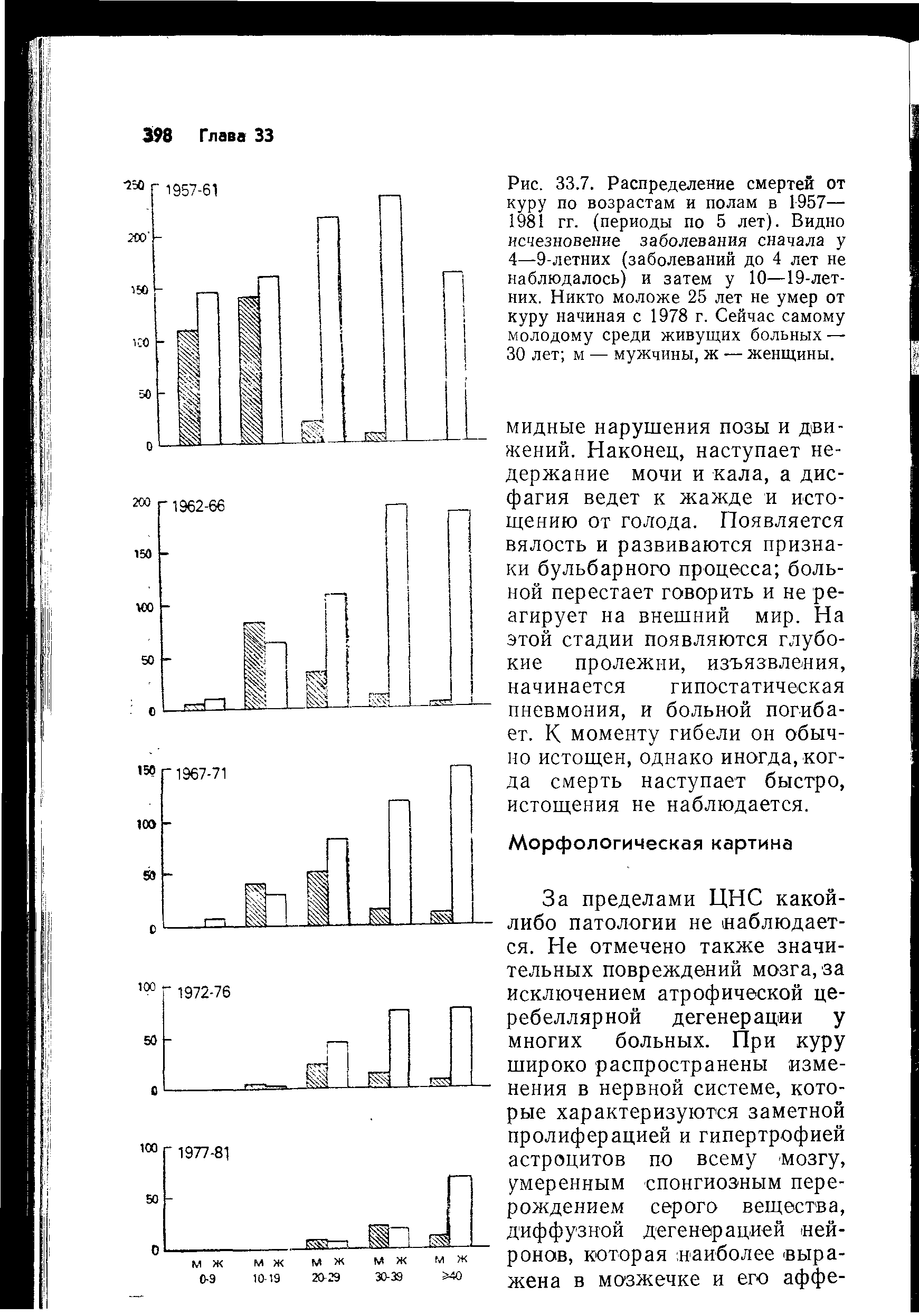 Рис. 33.7. Распределение смертей от куру по возрастам и полам в 1957— 1981 гг. (периоды по 5 лет). Видно исчезновение заболевания сначала у 4—9-летних (заболеваний до 4 лет не наблюдалось) и затем у 10—19-лет-них. Никто моложе 25 лет не умер от куру начиная с 1978 г. Сейчас самому молодому среди живущих больных — 30 лет м — мужчины, ж — женщины.