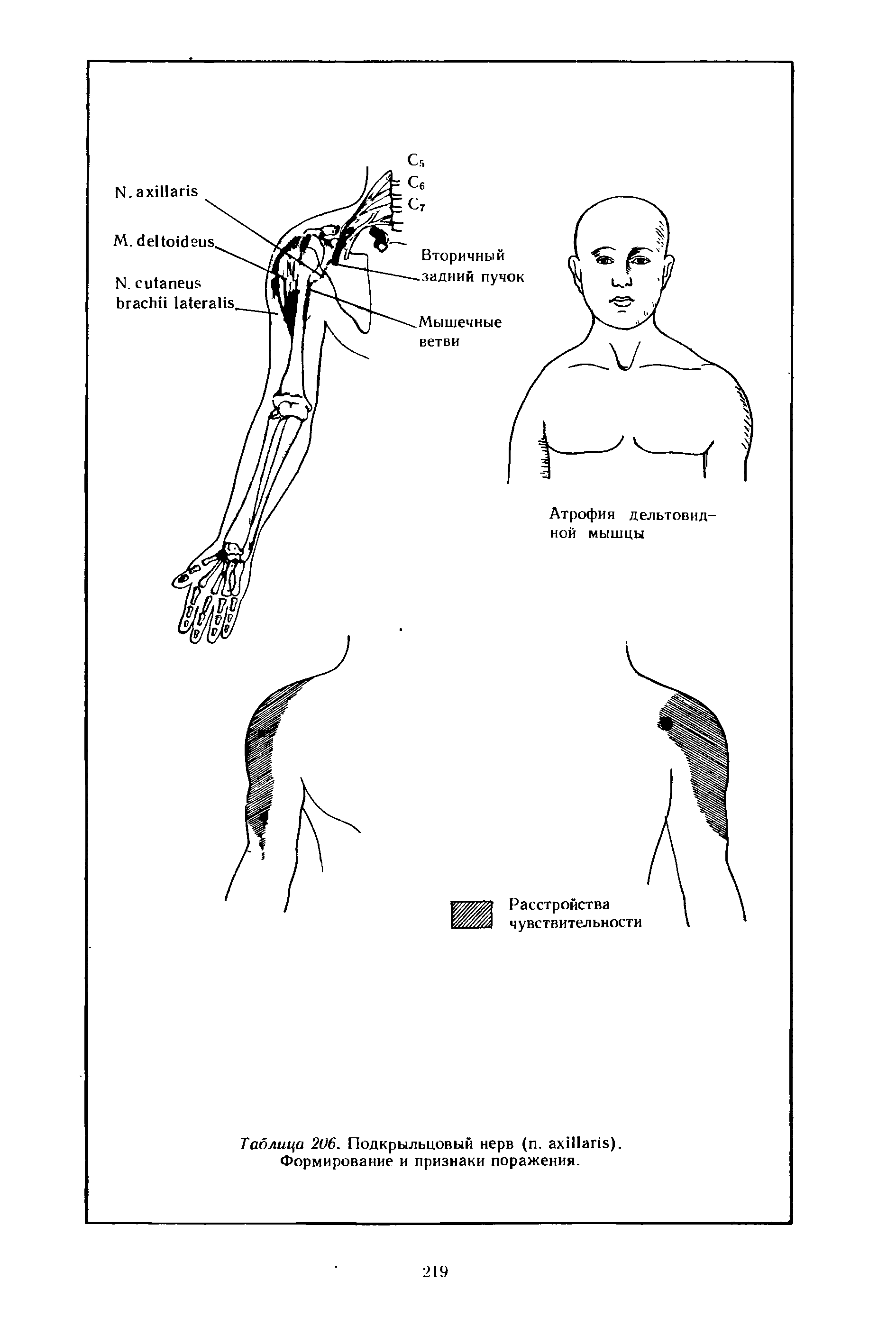 Таблица 206. Подкрыльцовый нерв ( . ). Формирование и признаки поражения.