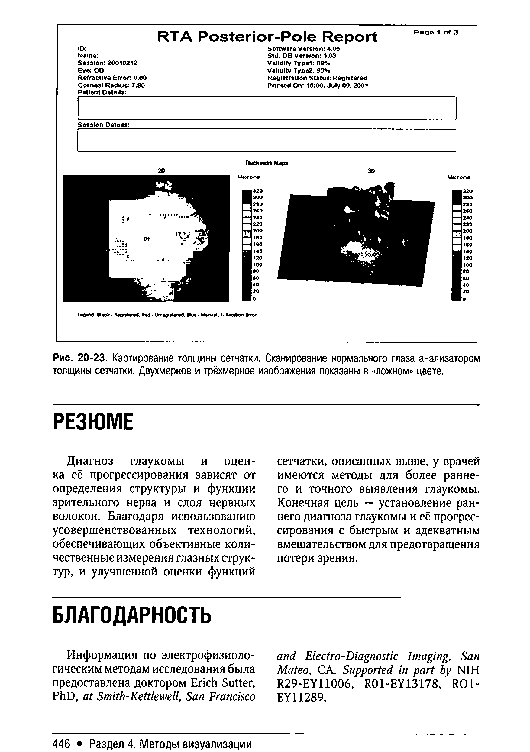 Рис. 20-23. Картирование толщины сетчатки. Сканирование нормального глаза анализатором толщины сетчатки. Двухмерное и трёхмерное изображения показаны в ложном цвете.