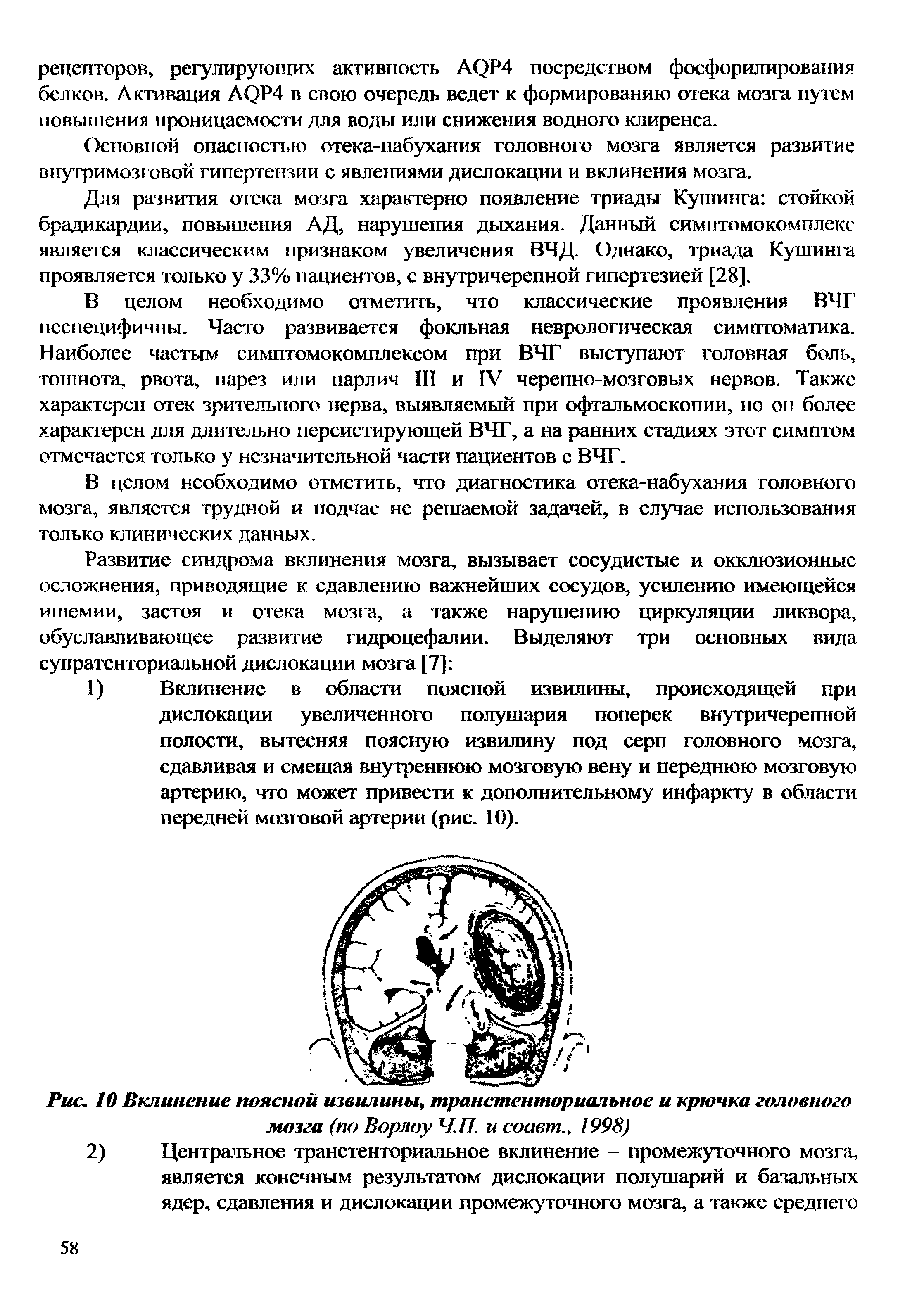 Рис. 10 Вклинение поясной извилины, транстенториальное и крючка головного...