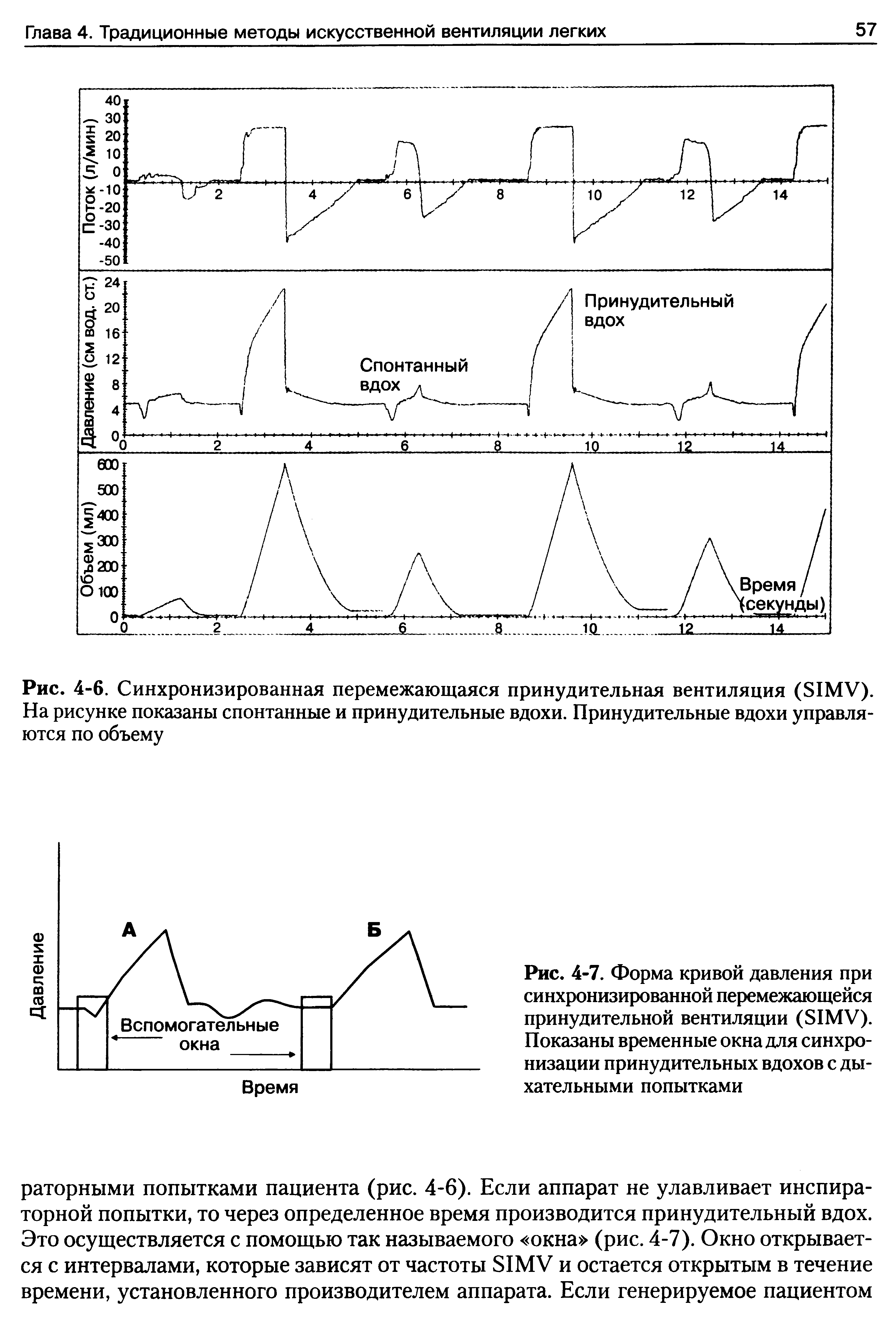 Рис. 4-7. Форма кривой давления при синхронизированной перемежающейся принудительной вентиляции (51МУ). Показаны временные окна для синхронизации принудительных вдохов с дыхательными попытками...