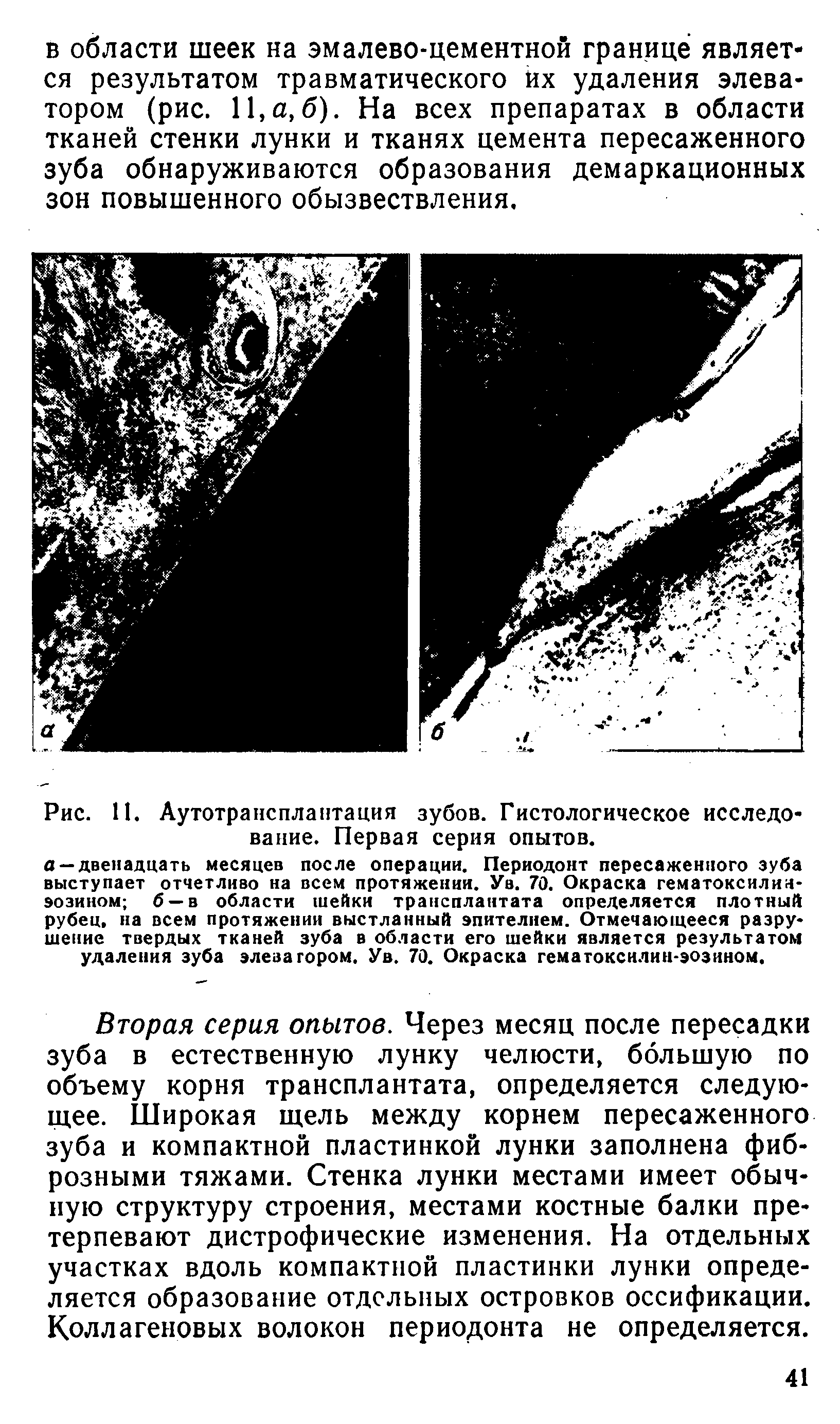 Рис. 11. Аутотрансплантация зубов. Гистологическое исследование. Первая серия опытов.