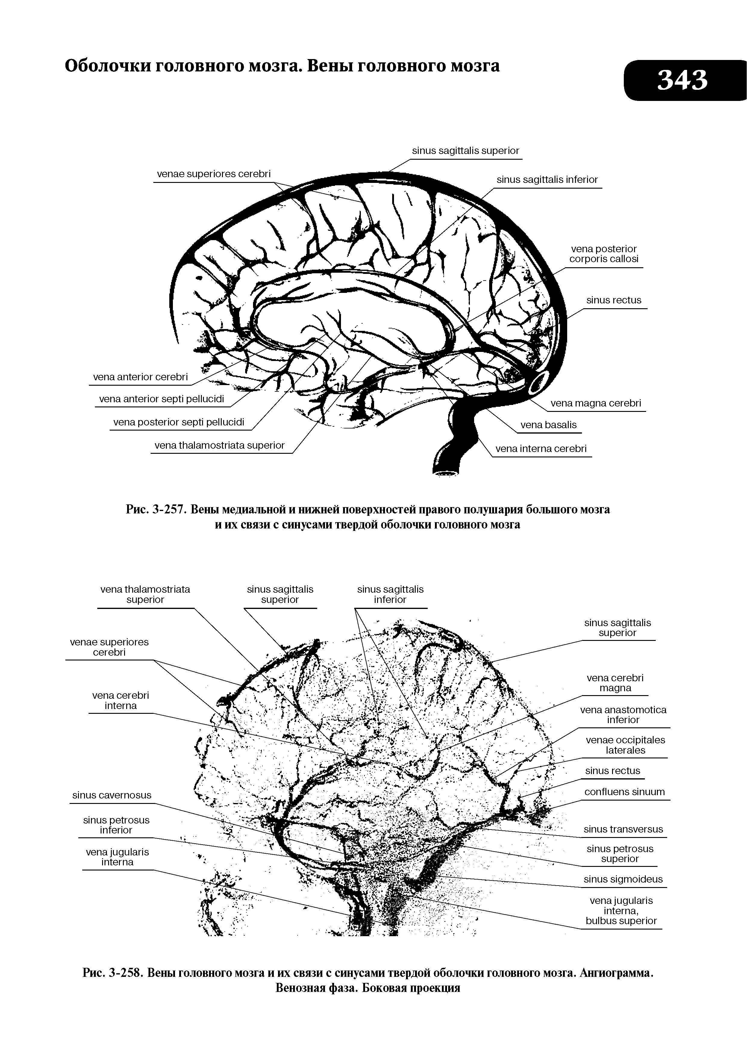 Рис. 3-258. Вены головного мозга и их связи с синусами твердой оболочки головного мозга. Ангиограмма. Венозная фаза. Боковая проекция...